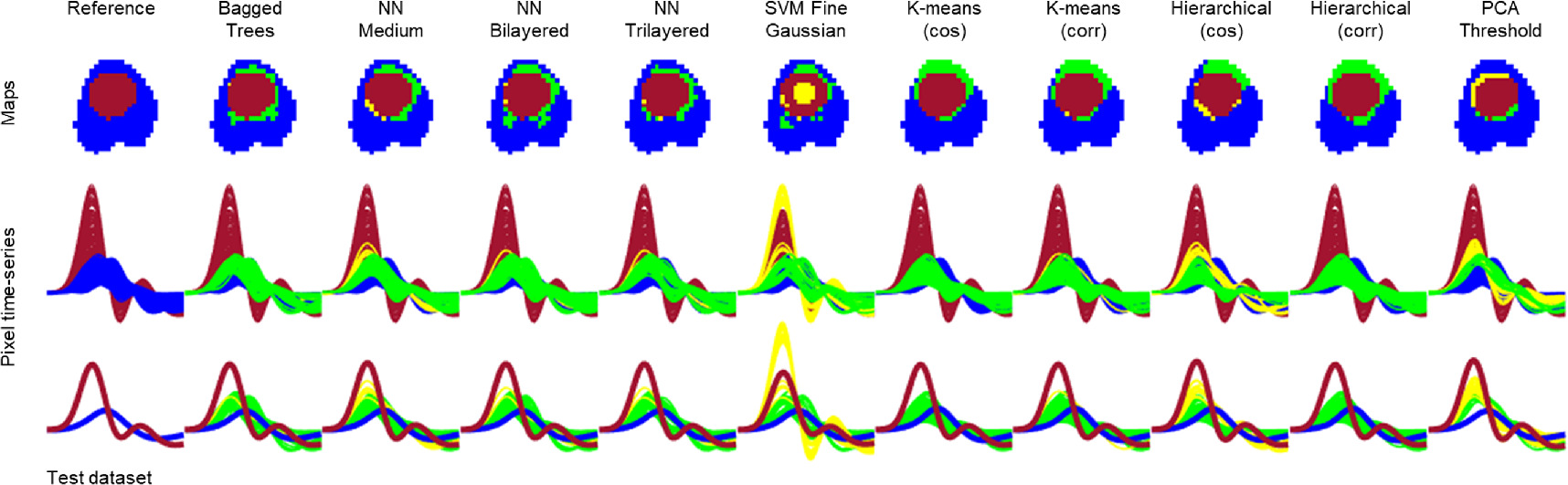 Supervised and unsupervised learning for lung perfusion data ...