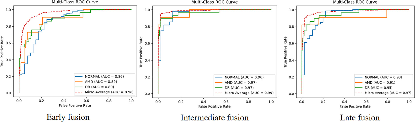 Multi-modal classification of retinal disease based on convolutional ...