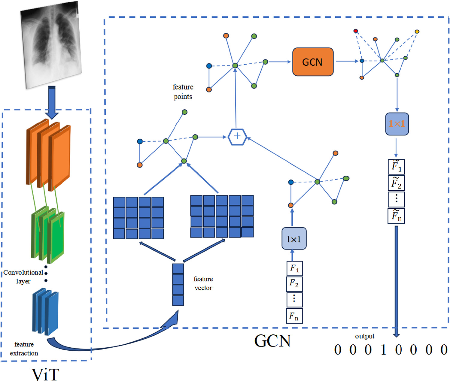 ViT-GCN: a novel hybrid model for accurate pneumonia diagnosis from x ...