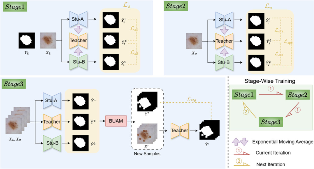 Semi-supervised medical image segmentation based on multi-stage ...
