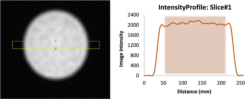 Development of a versatile image quality test phantom for single photon ...