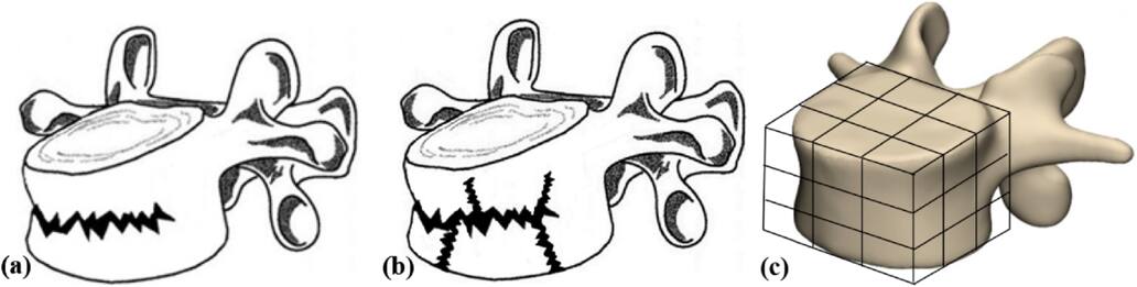 Application of virtual crack closure technique to simulate a burst