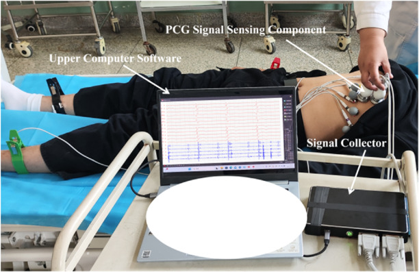 Machine learning-based CAD detection using integrated ECG and PCG ...