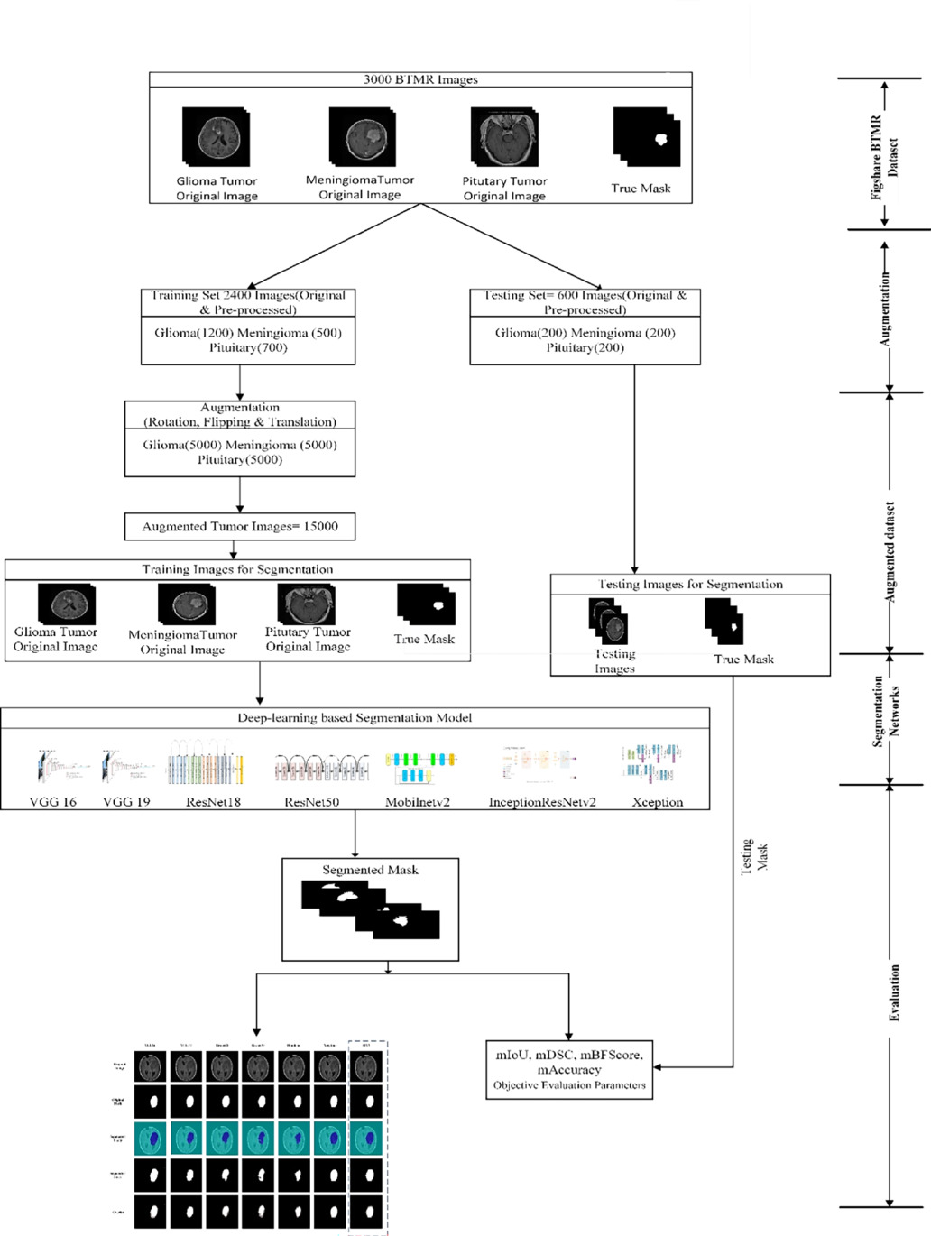 A hybrid model for brain tumor classification via deep feature ...