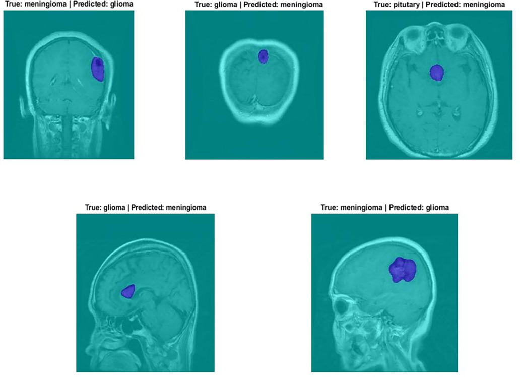 A hybrid model for brain tumor classification via deep feature ...