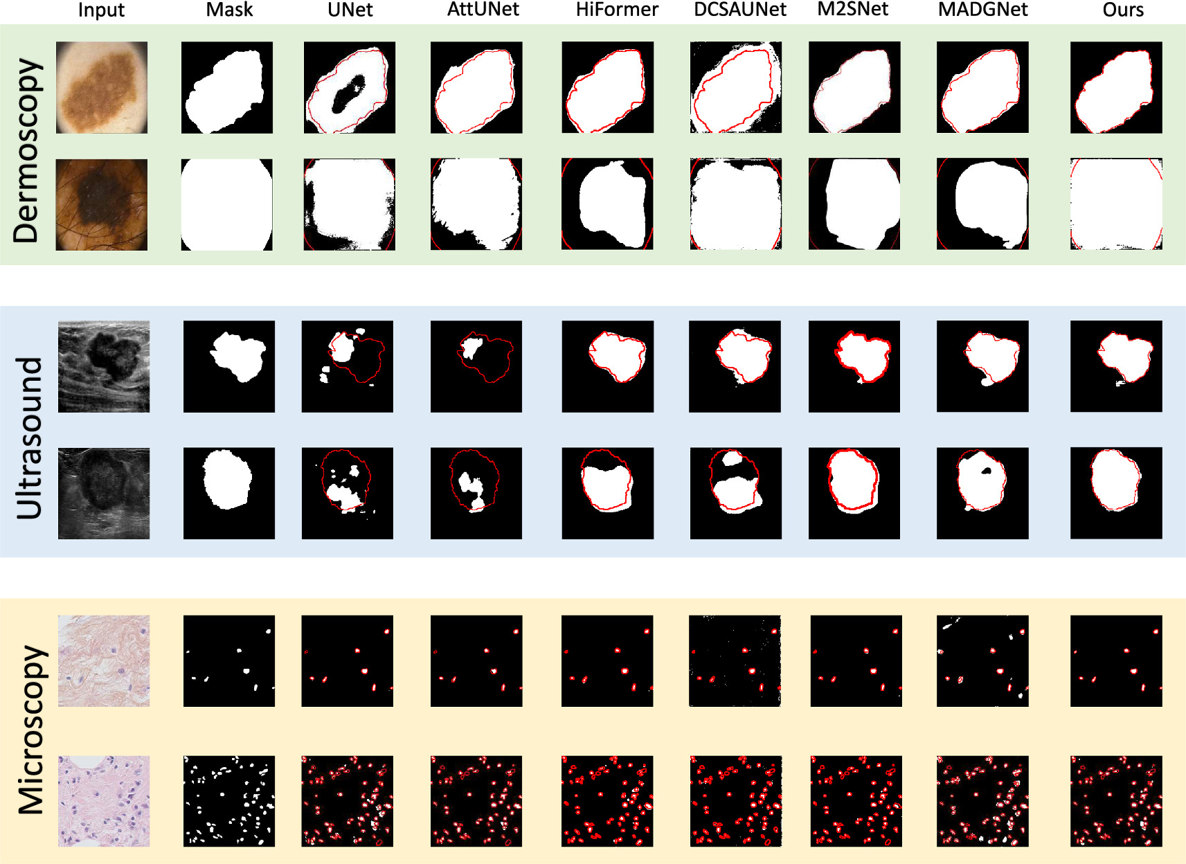 Generalizable 2D medical image segmentation via wavelet-guided spatial ...