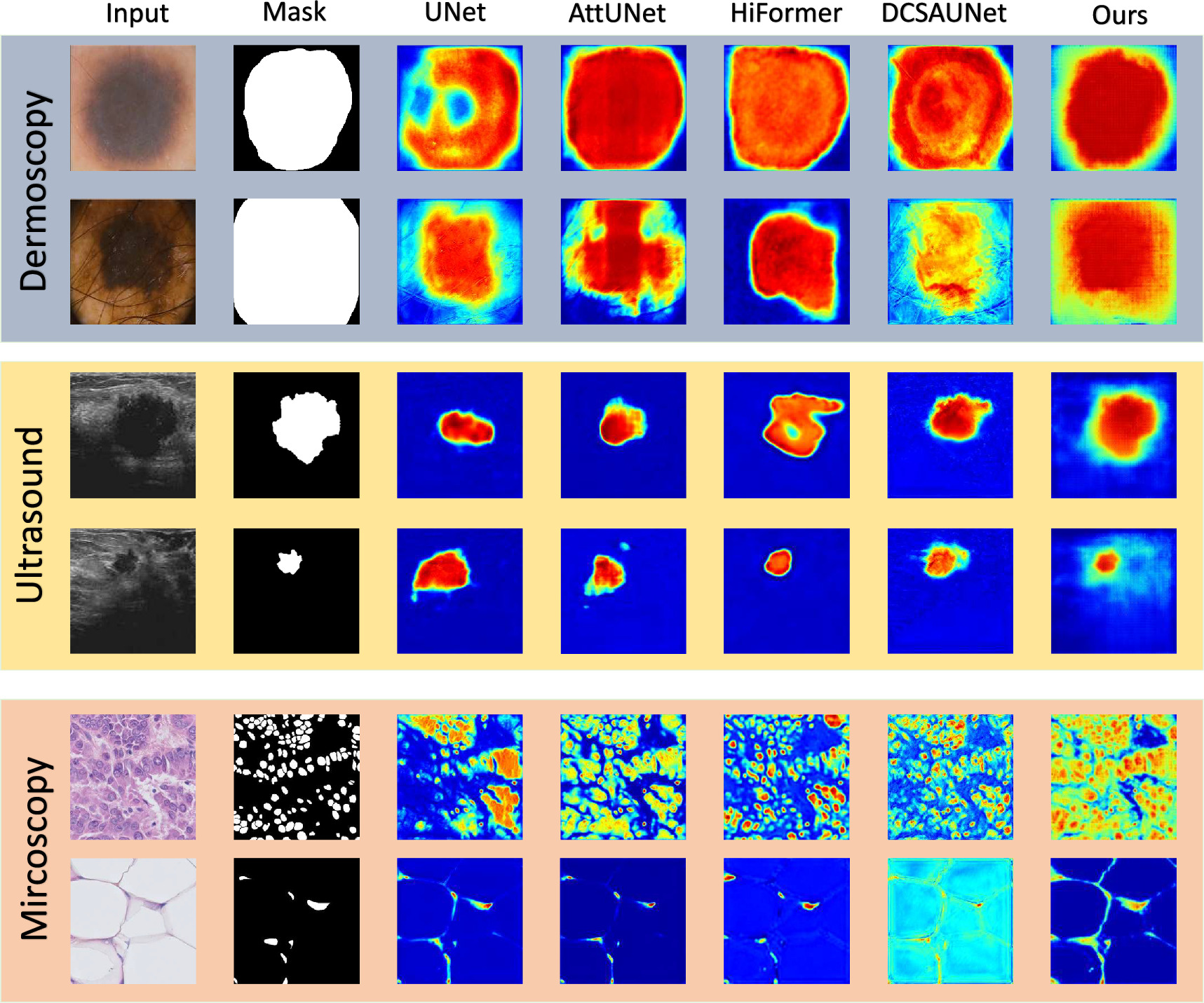 Generalizable 2D medical image segmentation via wavelet-guided spatial ...