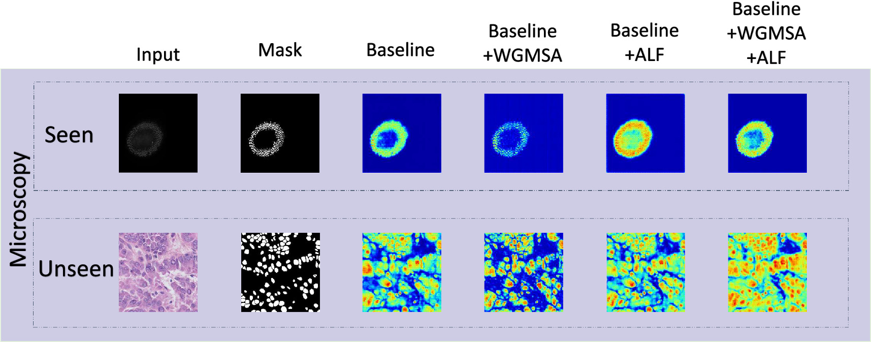 Generalizable 2D medical image segmentation via wavelet-guided spatial ...