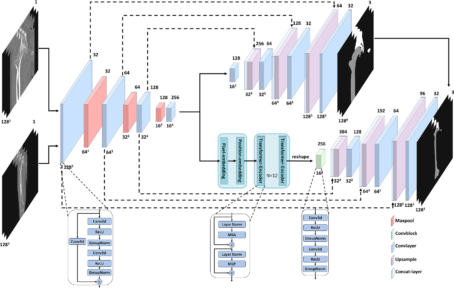 A 3D multi-task network for the automatic segmentation of CT images ...