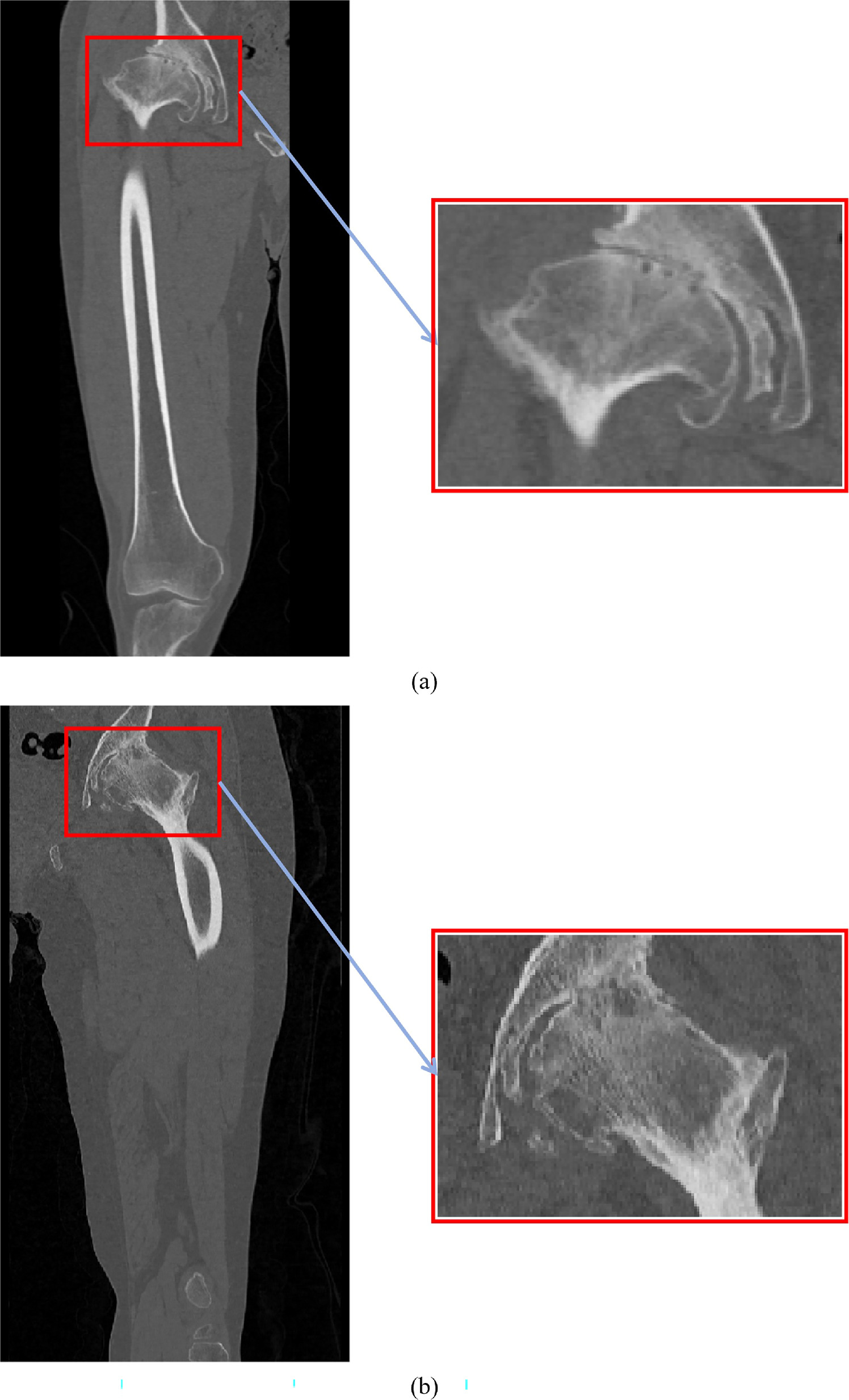 A 3D multi-task network for the automatic segmentation of CT images ...