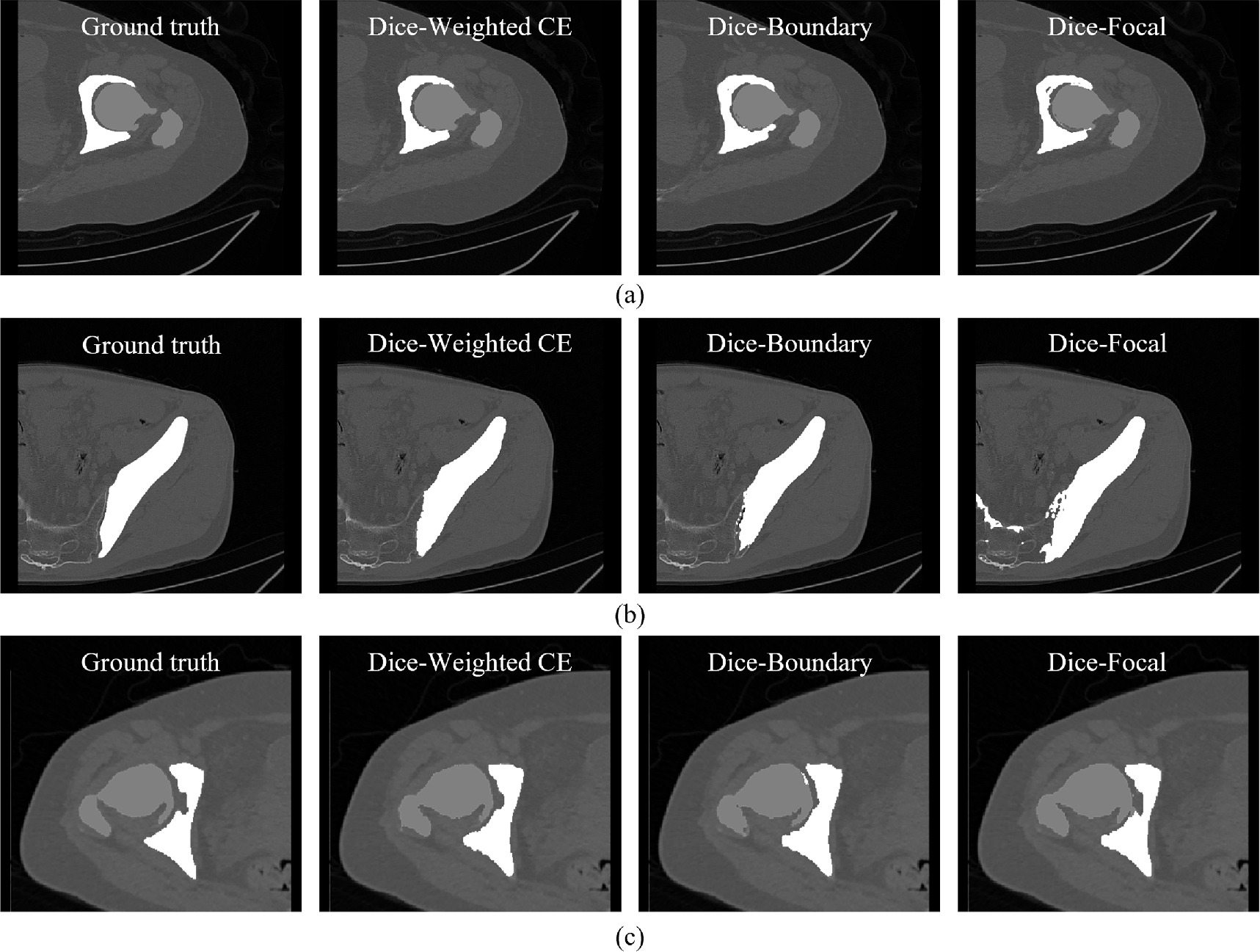A 3D multi-task network for the automatic segmentation of CT images ...