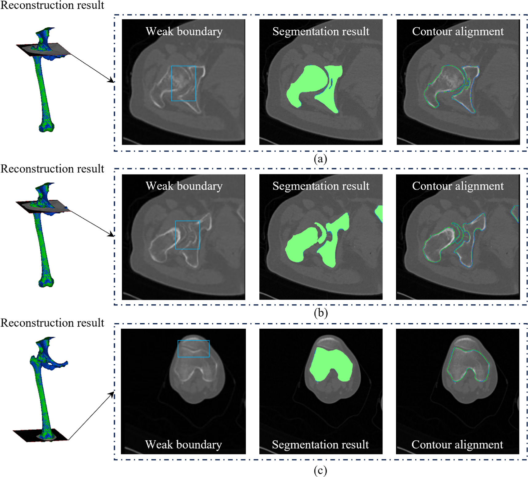 A 3D multi-task network for the automatic segmentation of CT images ...