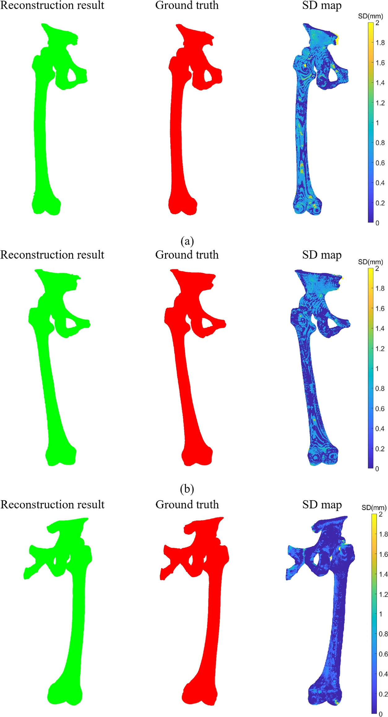 A 3D multi-task network for the automatic segmentation of CT images ...