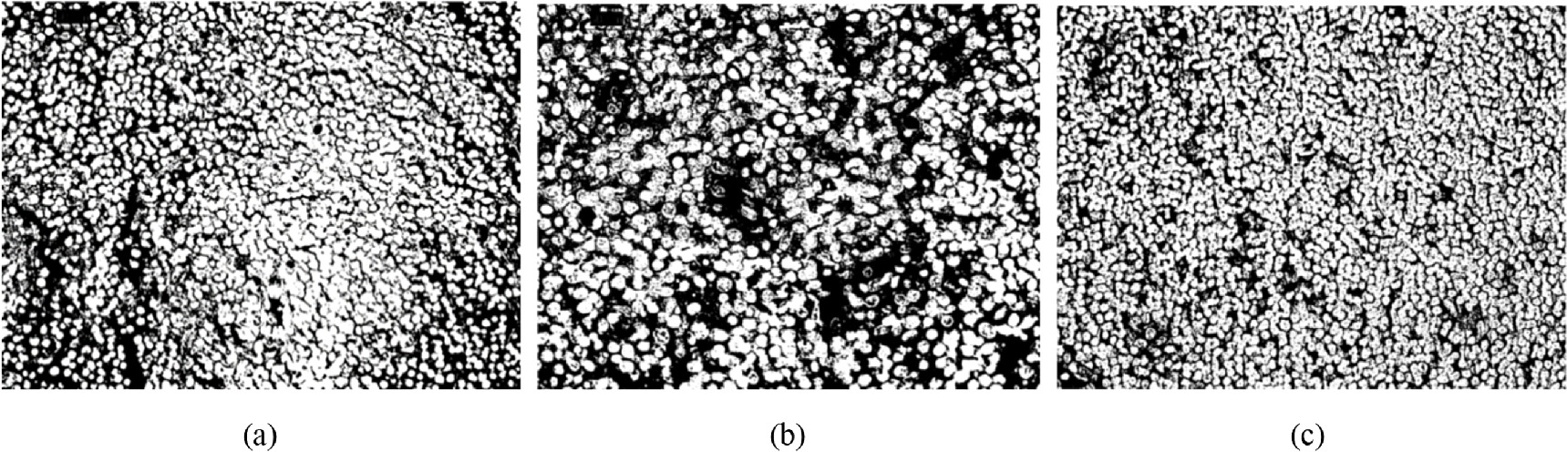 Automated quantification and feature extraction of nuclei in diffuse ...