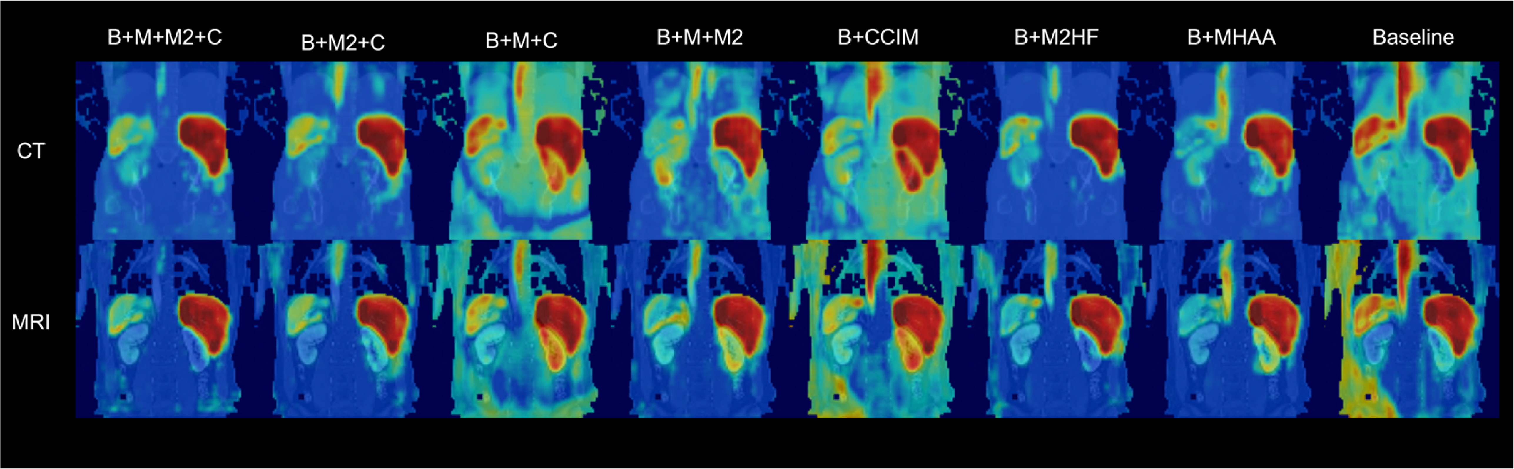 Multi-modal semi-supervised medical image segmentation via spatial ...