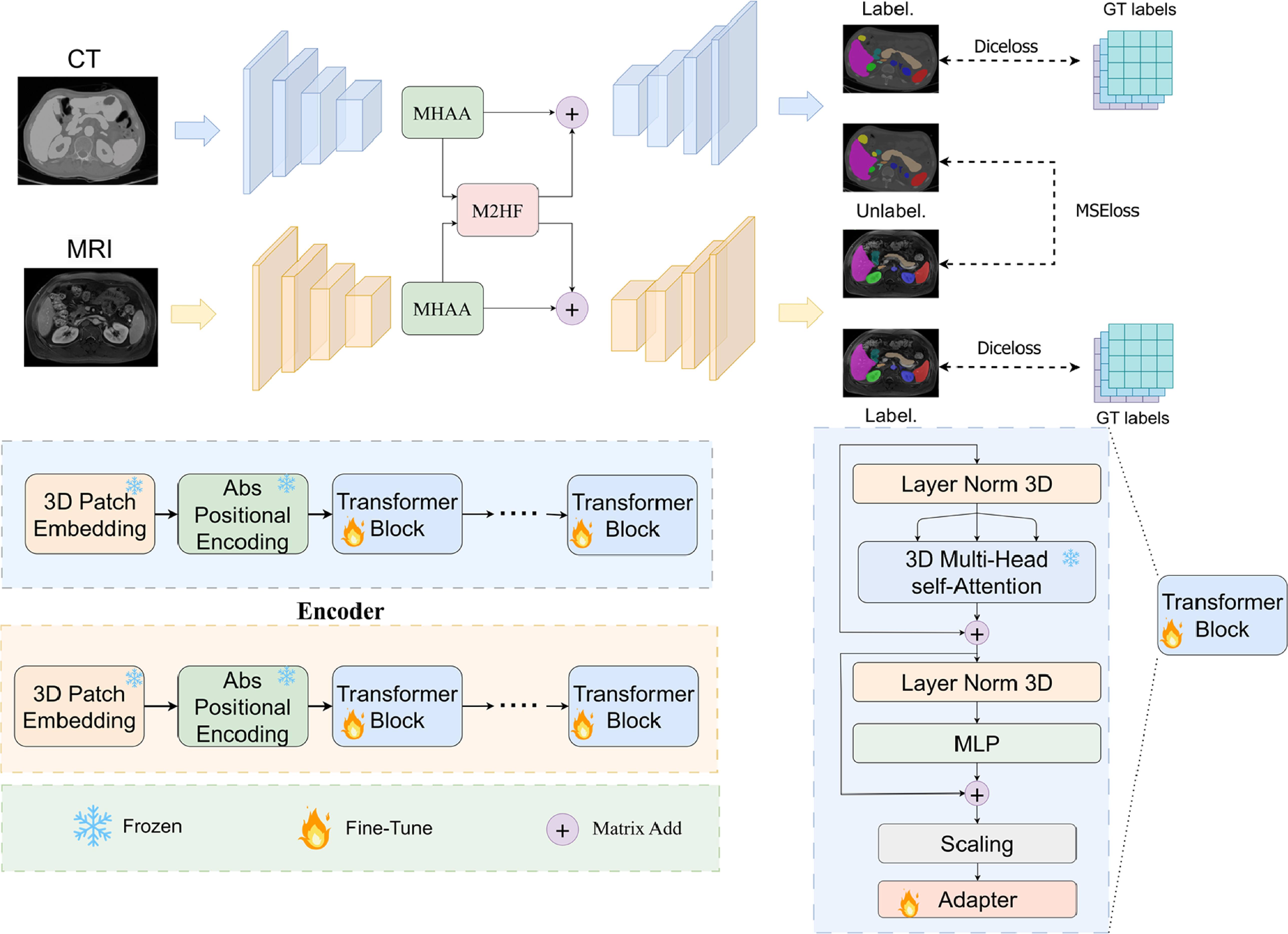 Multi-modal semi-supervised medical image segmentation via spatial ...
