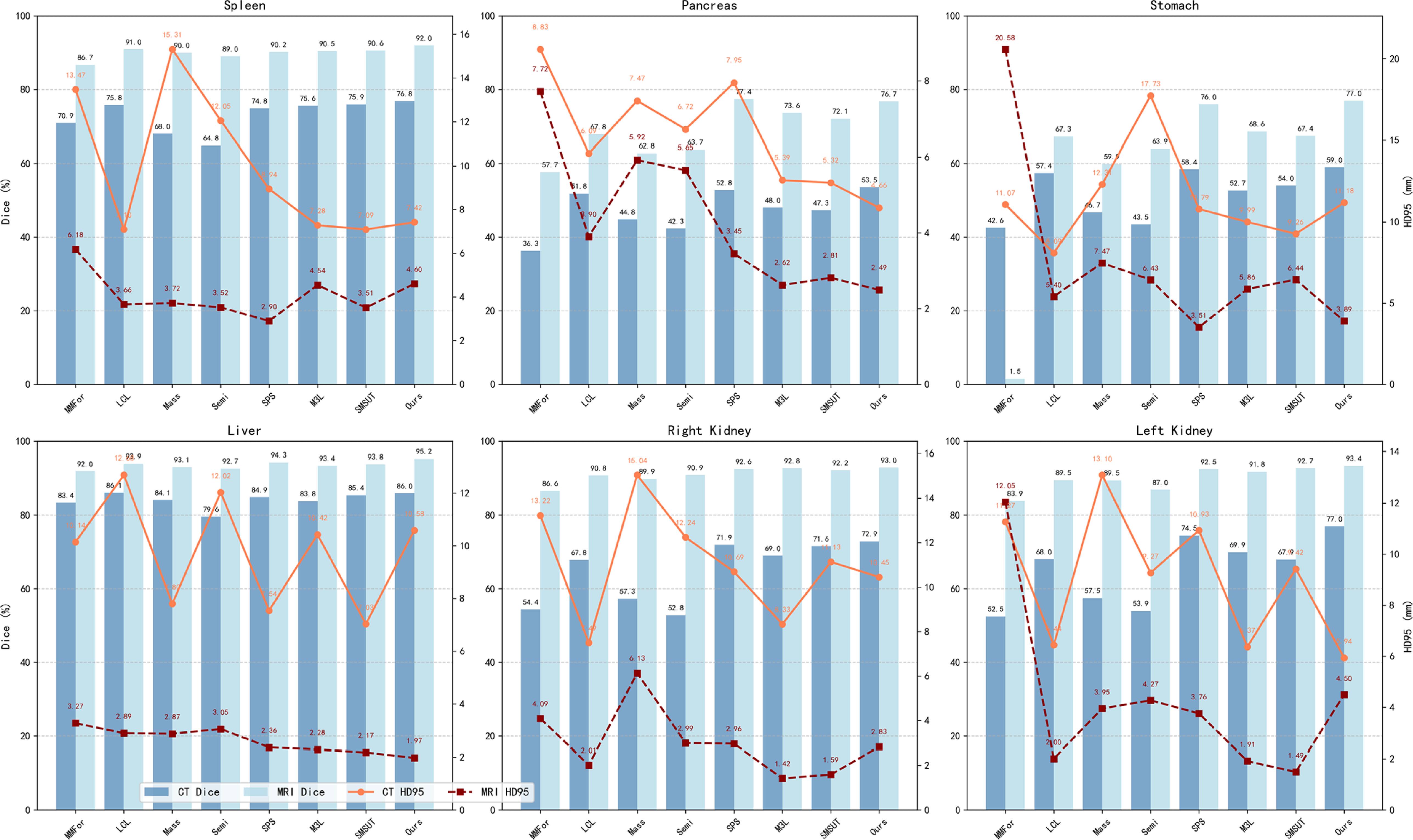 Multi-modal semi-supervised medical image segmentation via spatial ...