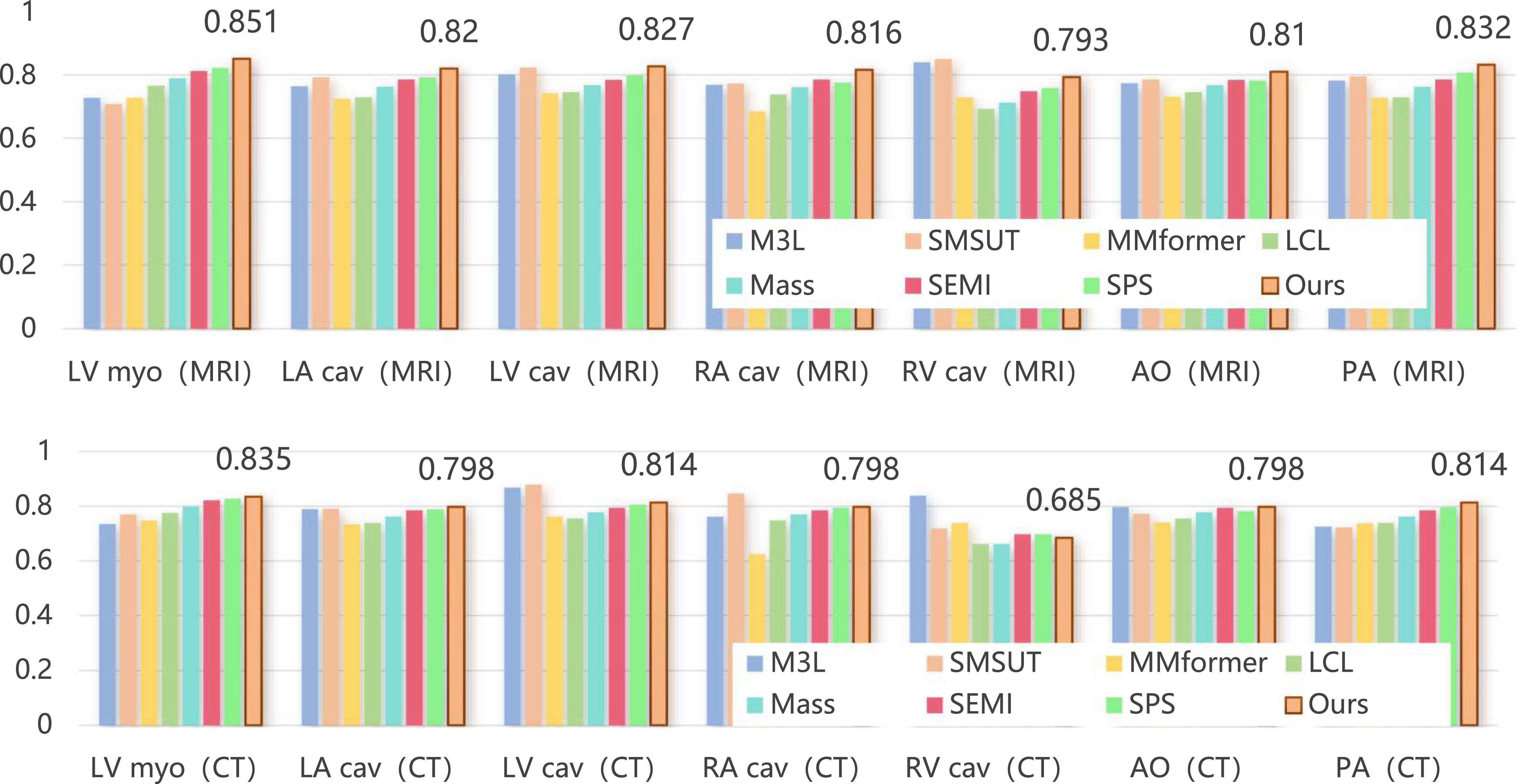 Multi-modal semi-supervised medical image segmentation via spatial ...