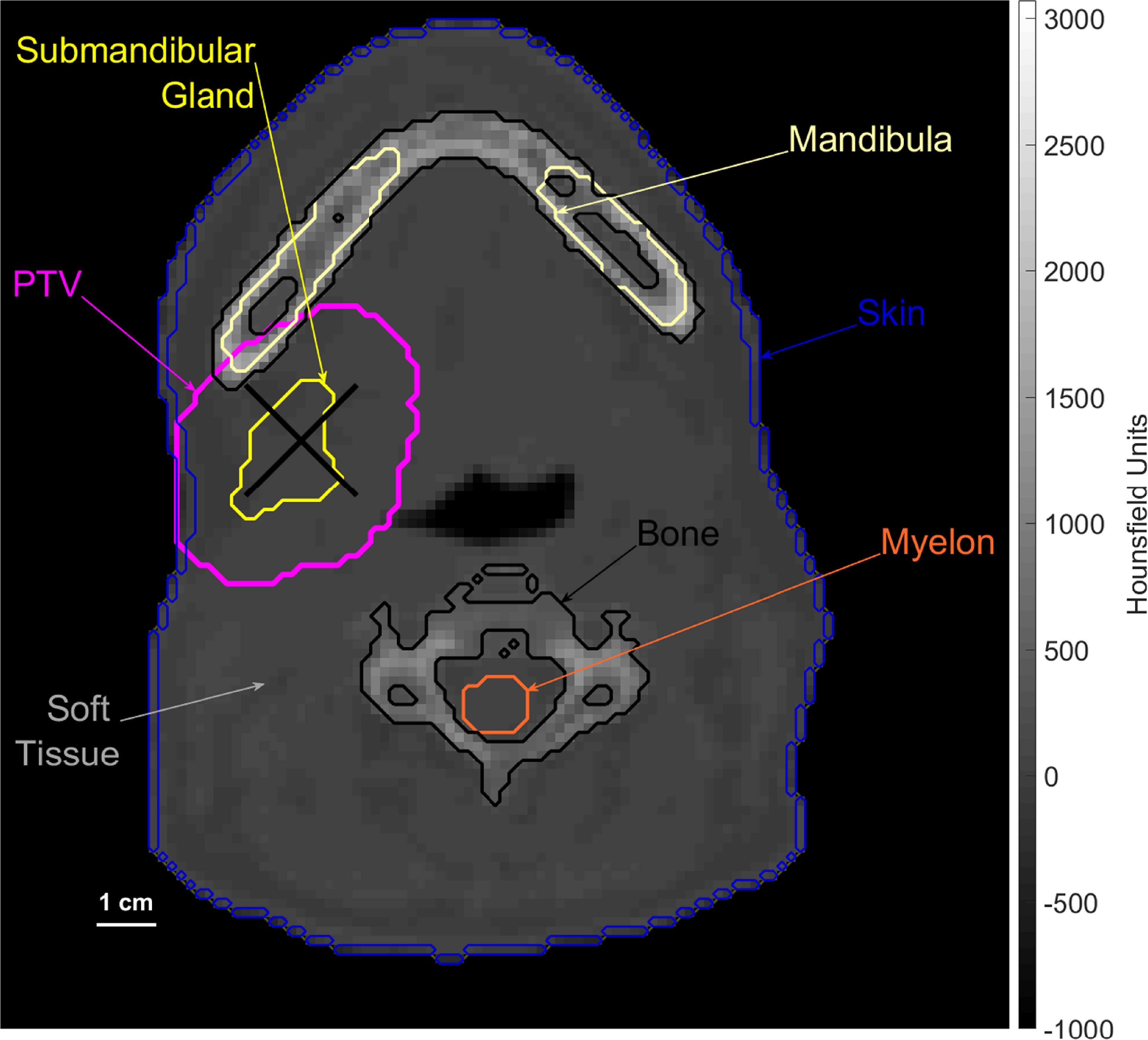 Matrad A Monte Carlo dose engine for fast neutron therapy and boron neutron ...