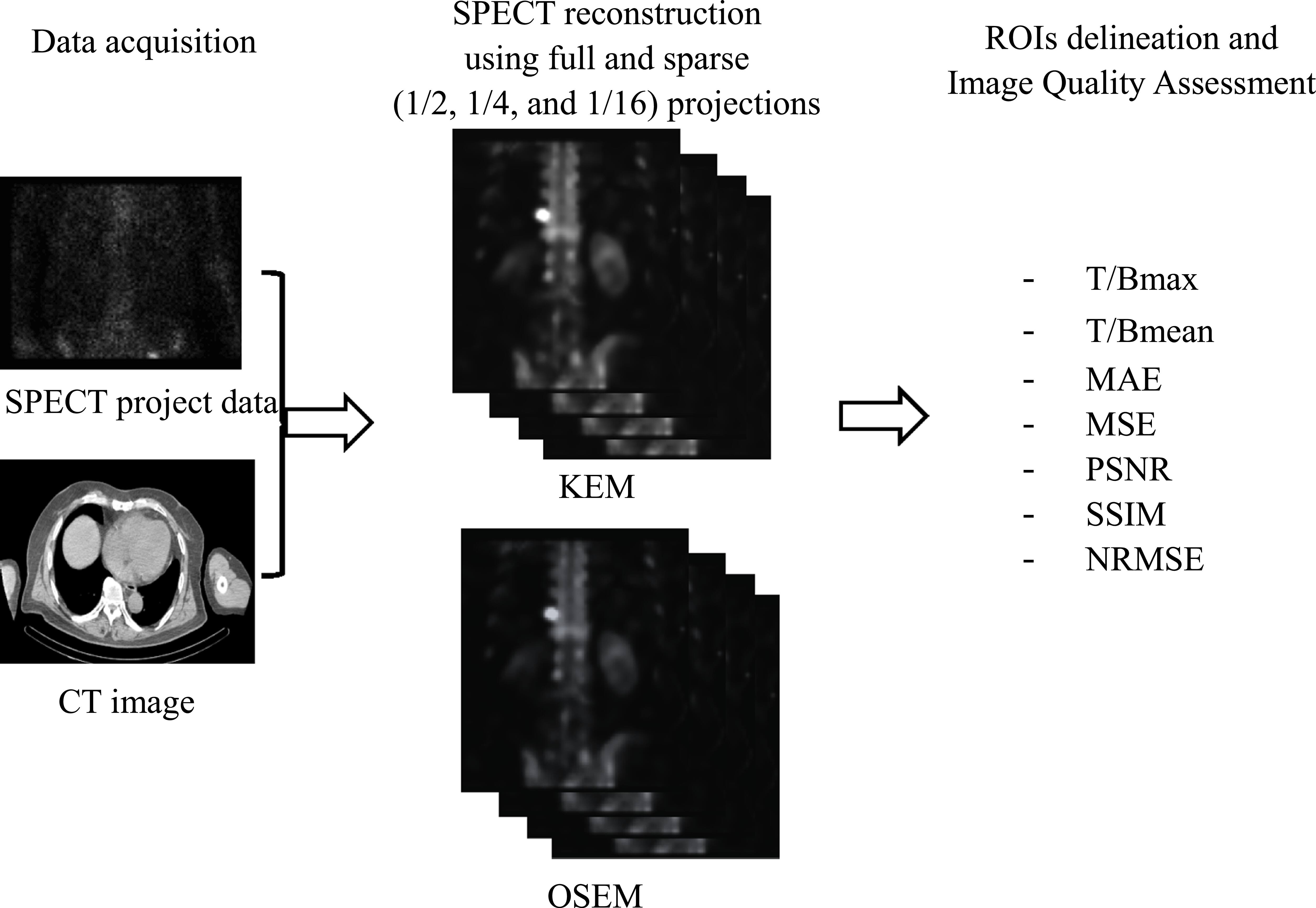 Anatomically CT-guided iterative reconstruction using KEM for sparse ...