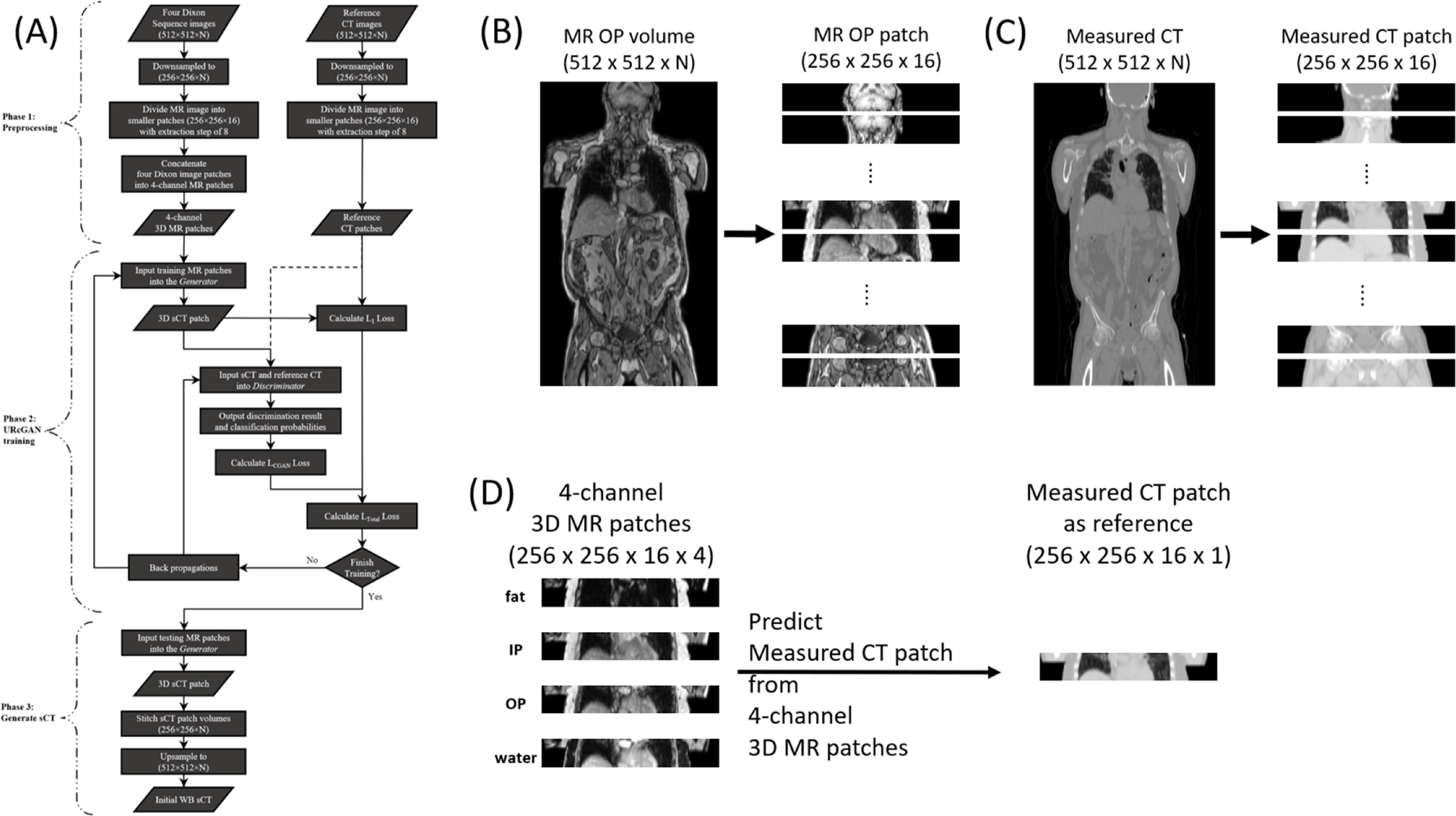 Torso synthetic CT generation by integrating deep learning and ...