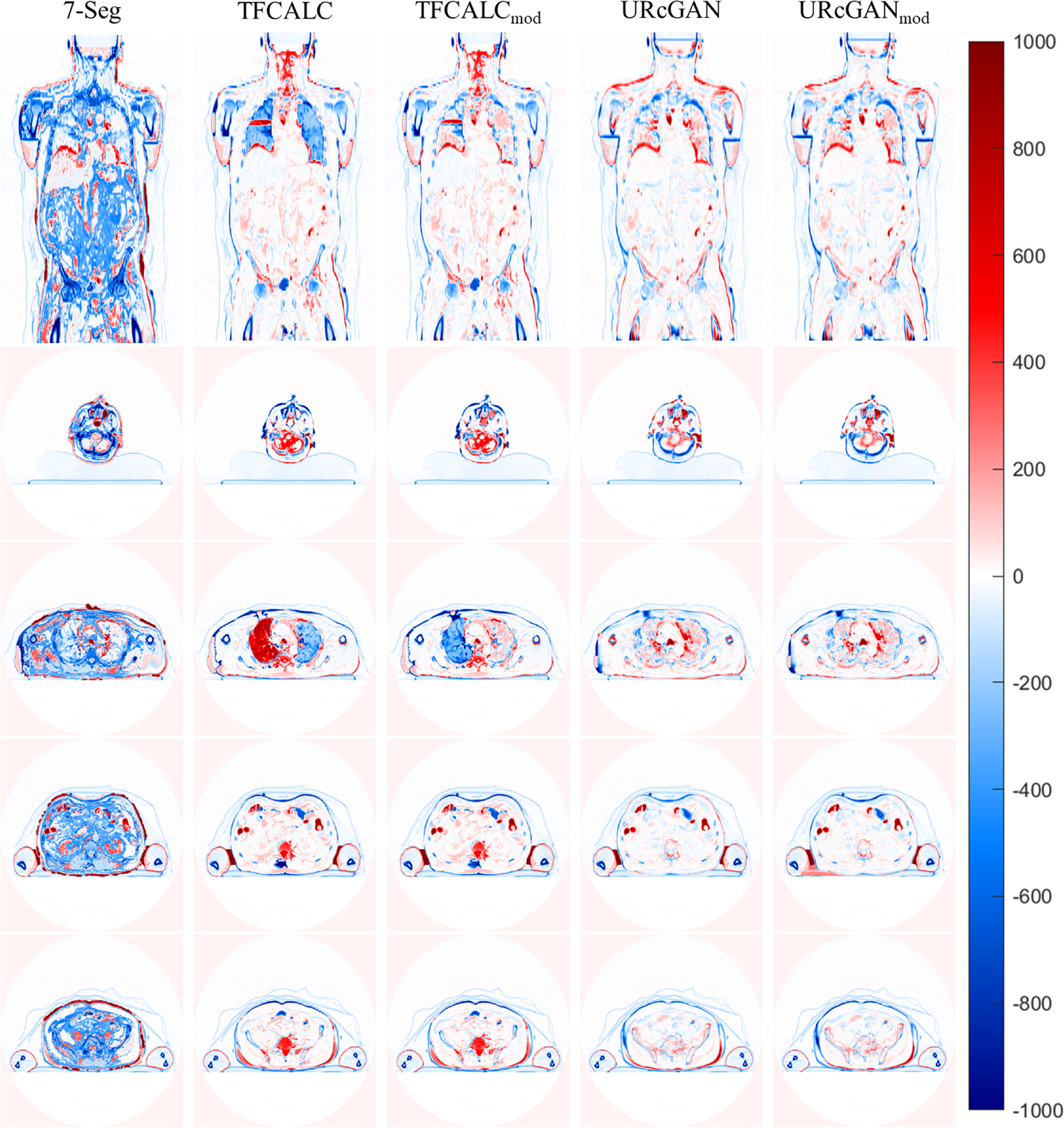 Torso synthetic CT generation by integrating deep learning and ...