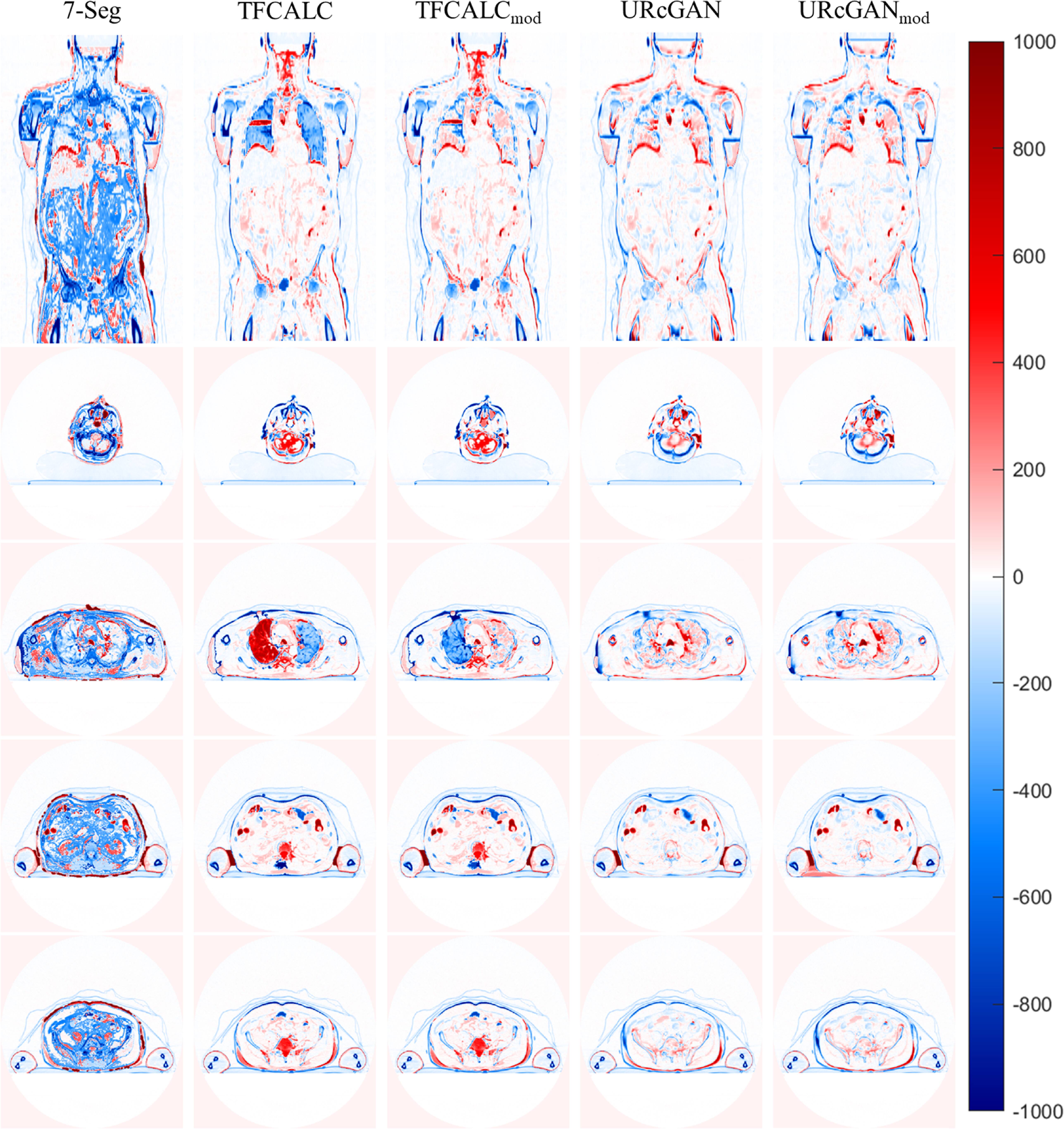 Torso synthetic CT generation by integrating deep learning and ...