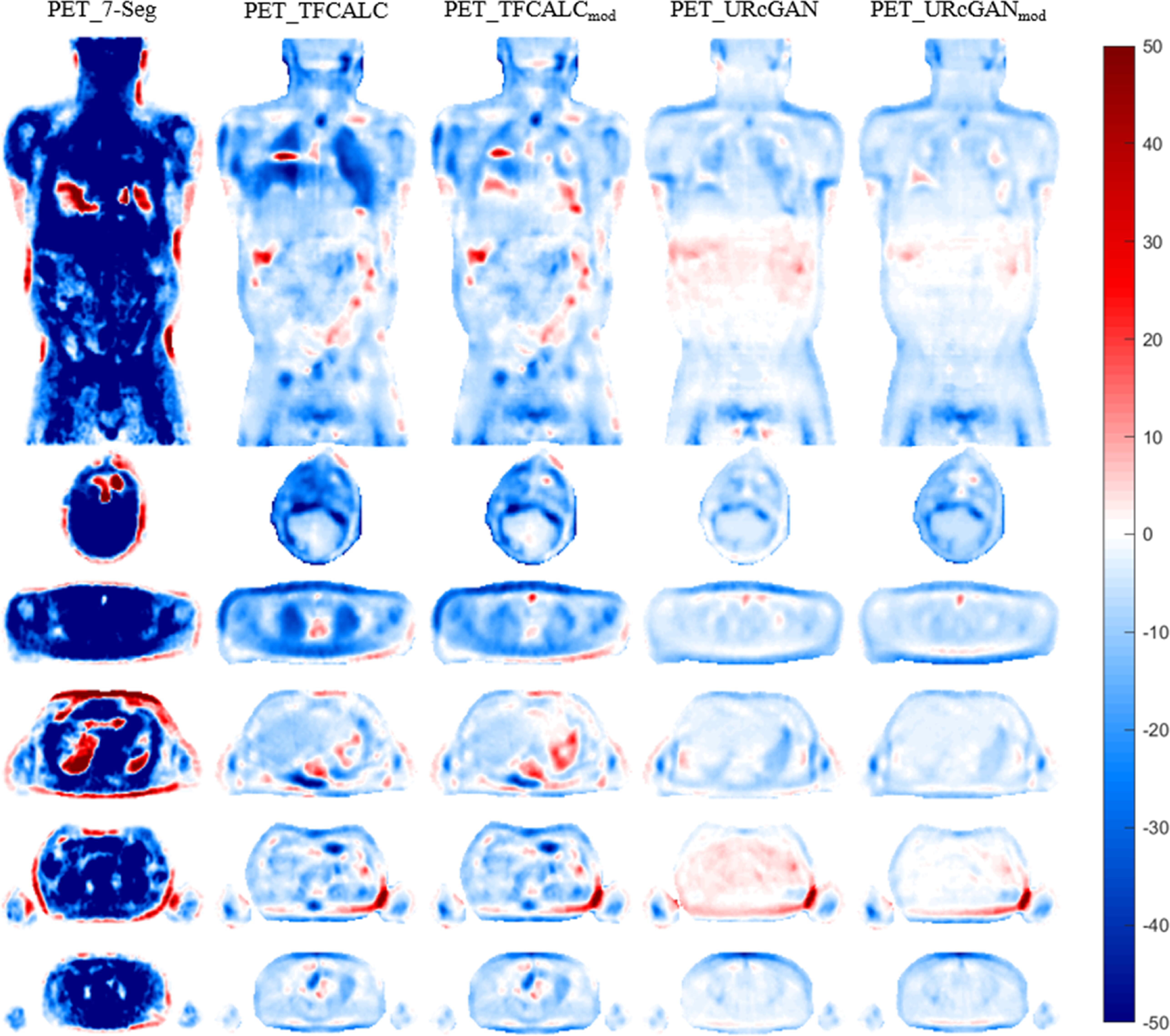 Torso synthetic CT generation by integrating deep learning and ...