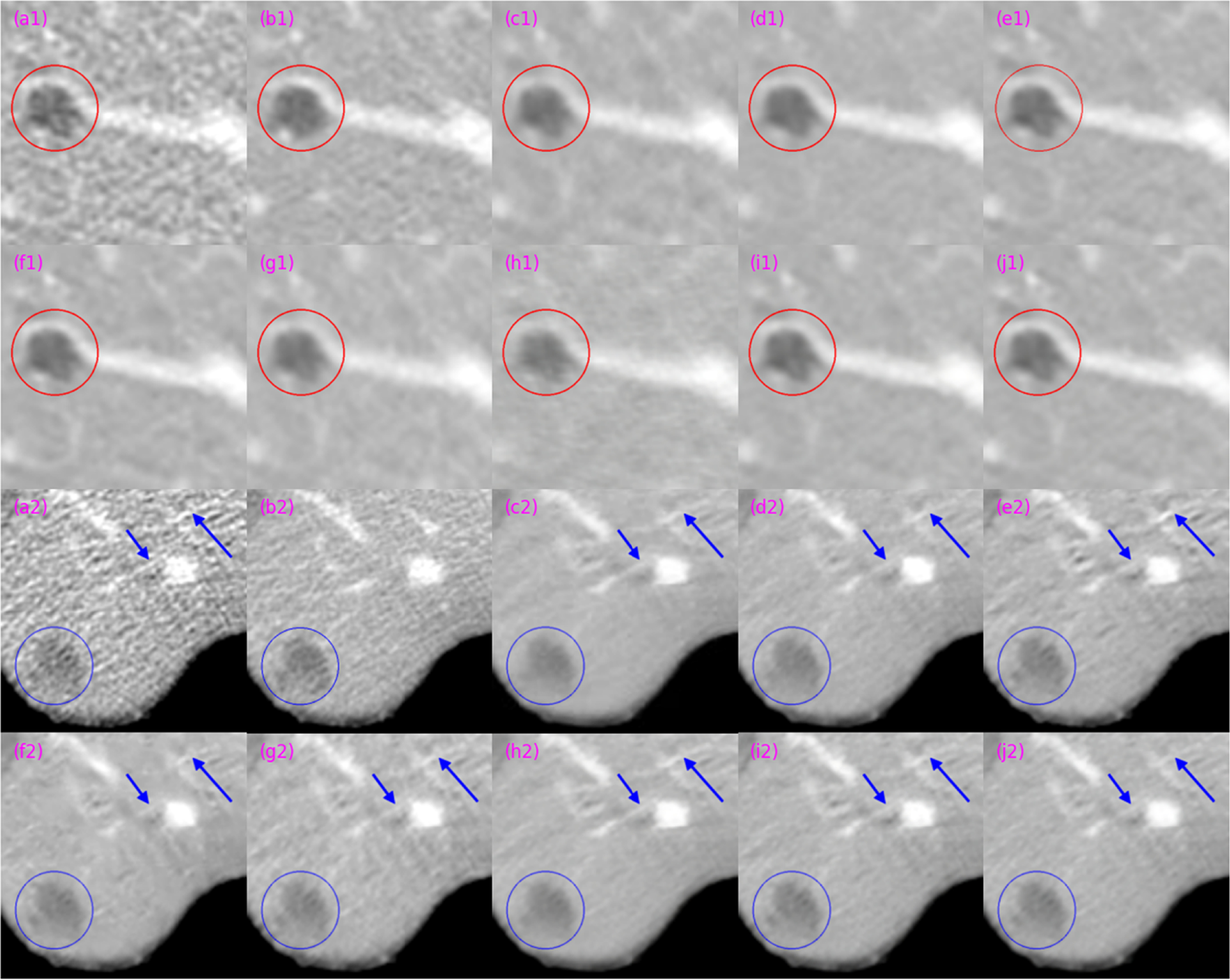 CSCST-Net: a fully sparse-regularized convolutional sparse coding ...