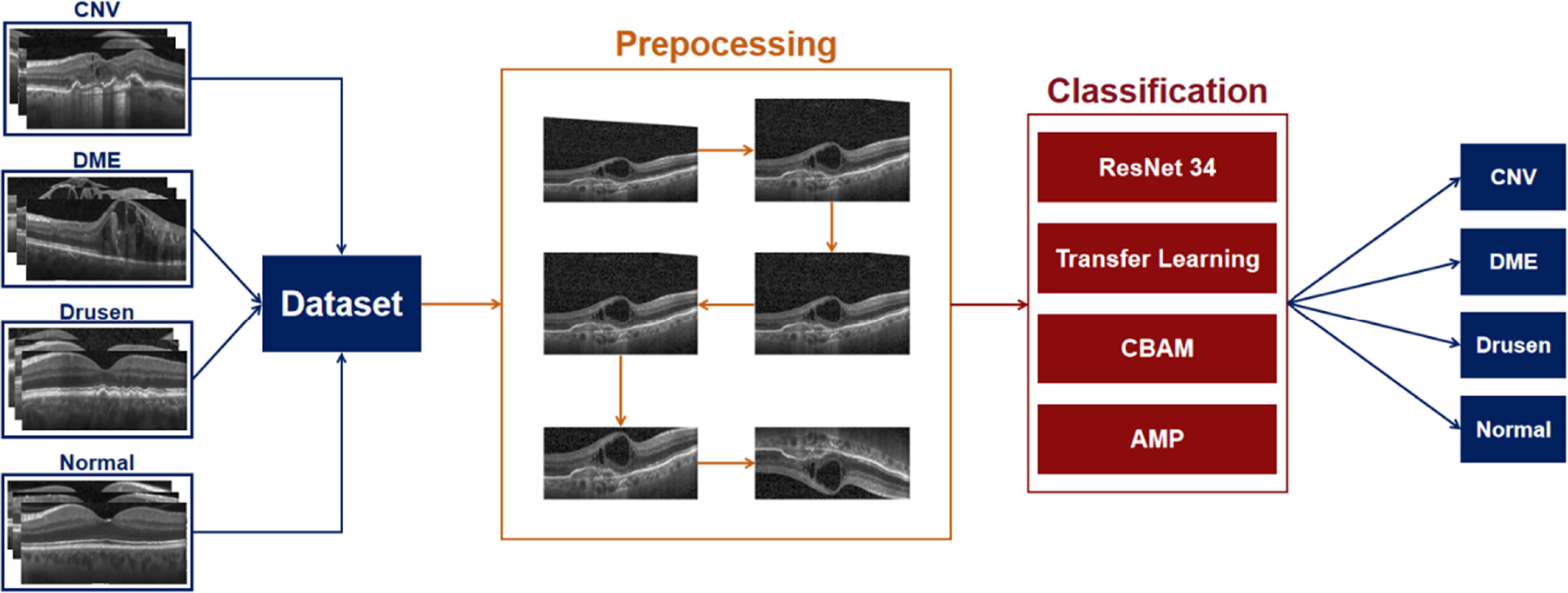An OCT retinal image classification model based on improved ResNet-34 ...
