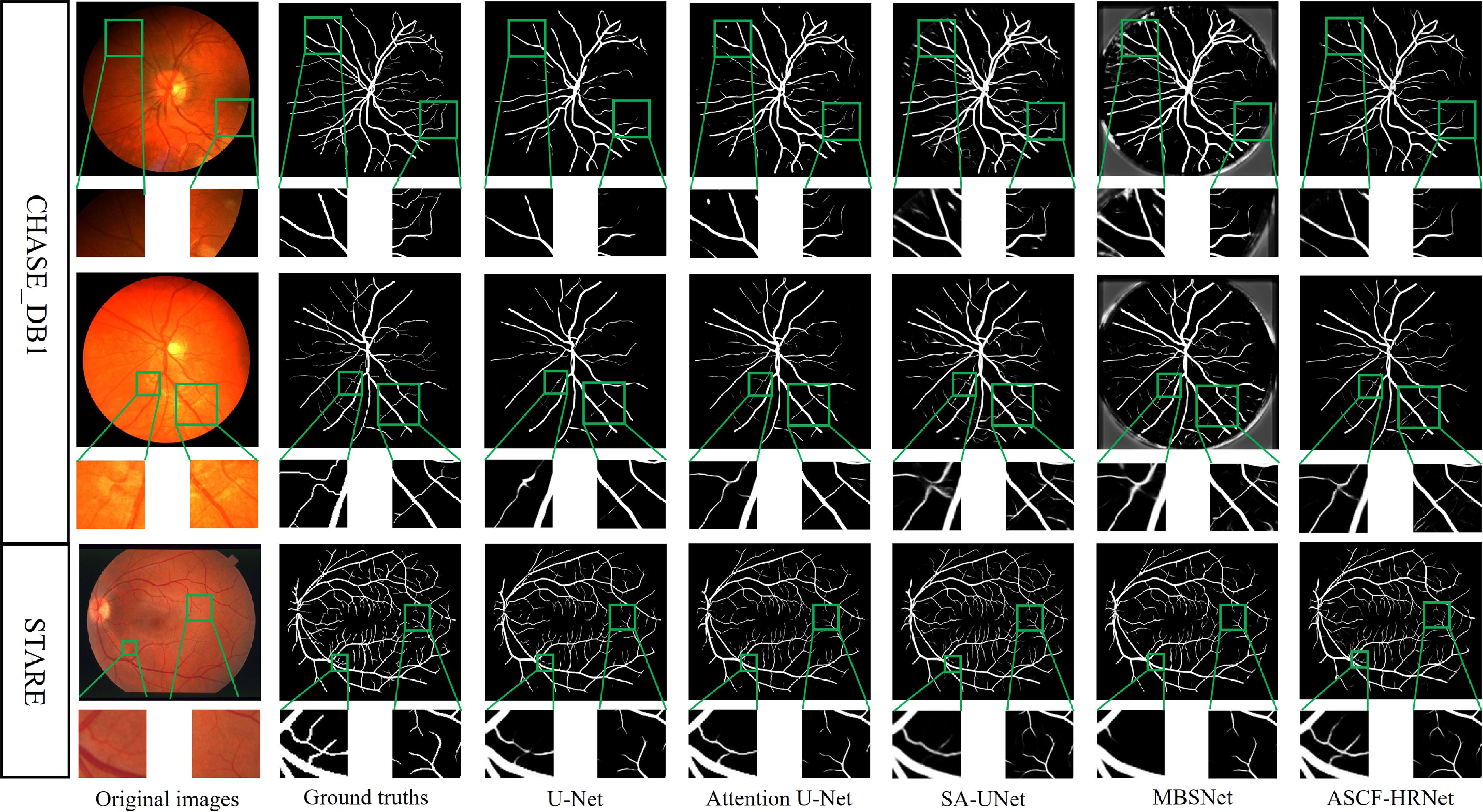 A high-resolution network with adaptive spatial channel fusion for ...
