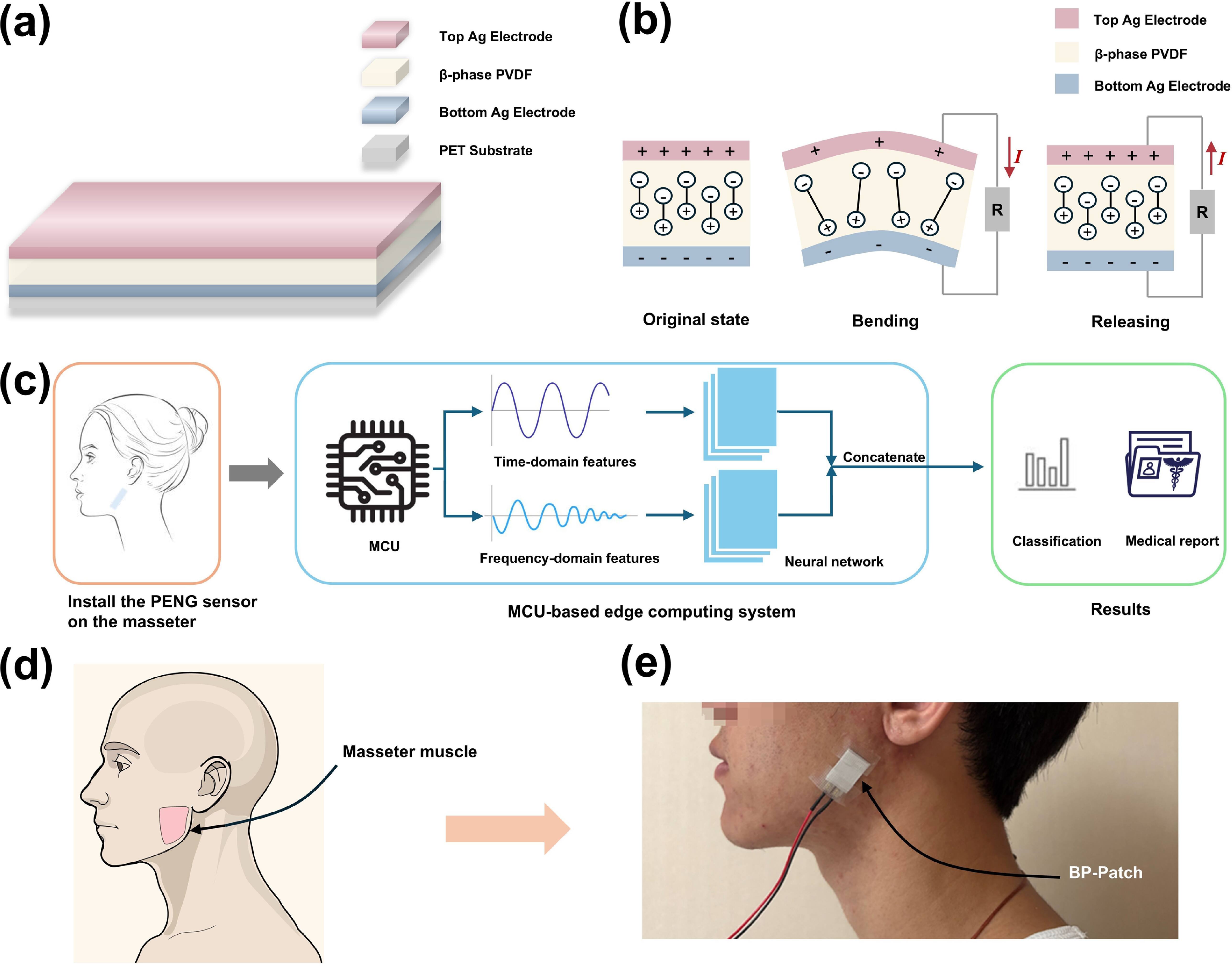 Towards interpretable and edge-intelligent masseter monitoring: a self ...