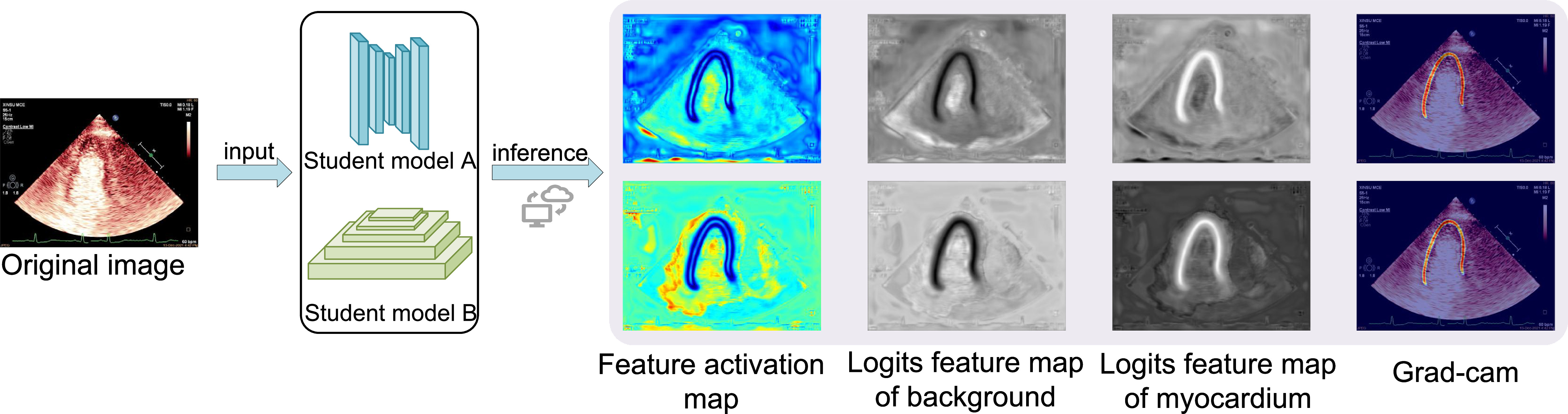 SSMCE: A semi-supervised learning framework for myocardial segmentation ...