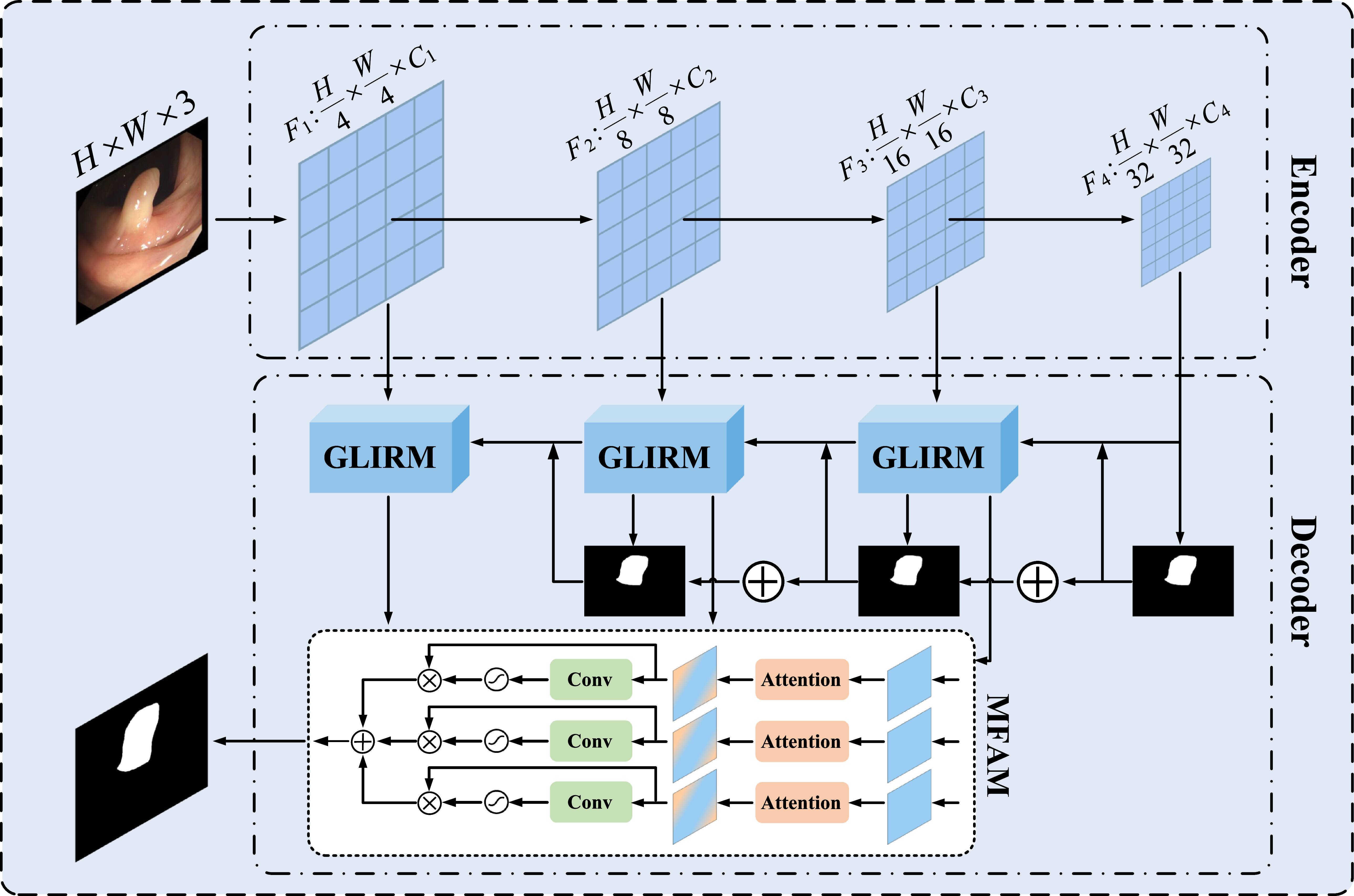 PGMNet: a polyp segmentation network based on bit-plane slicing and ...