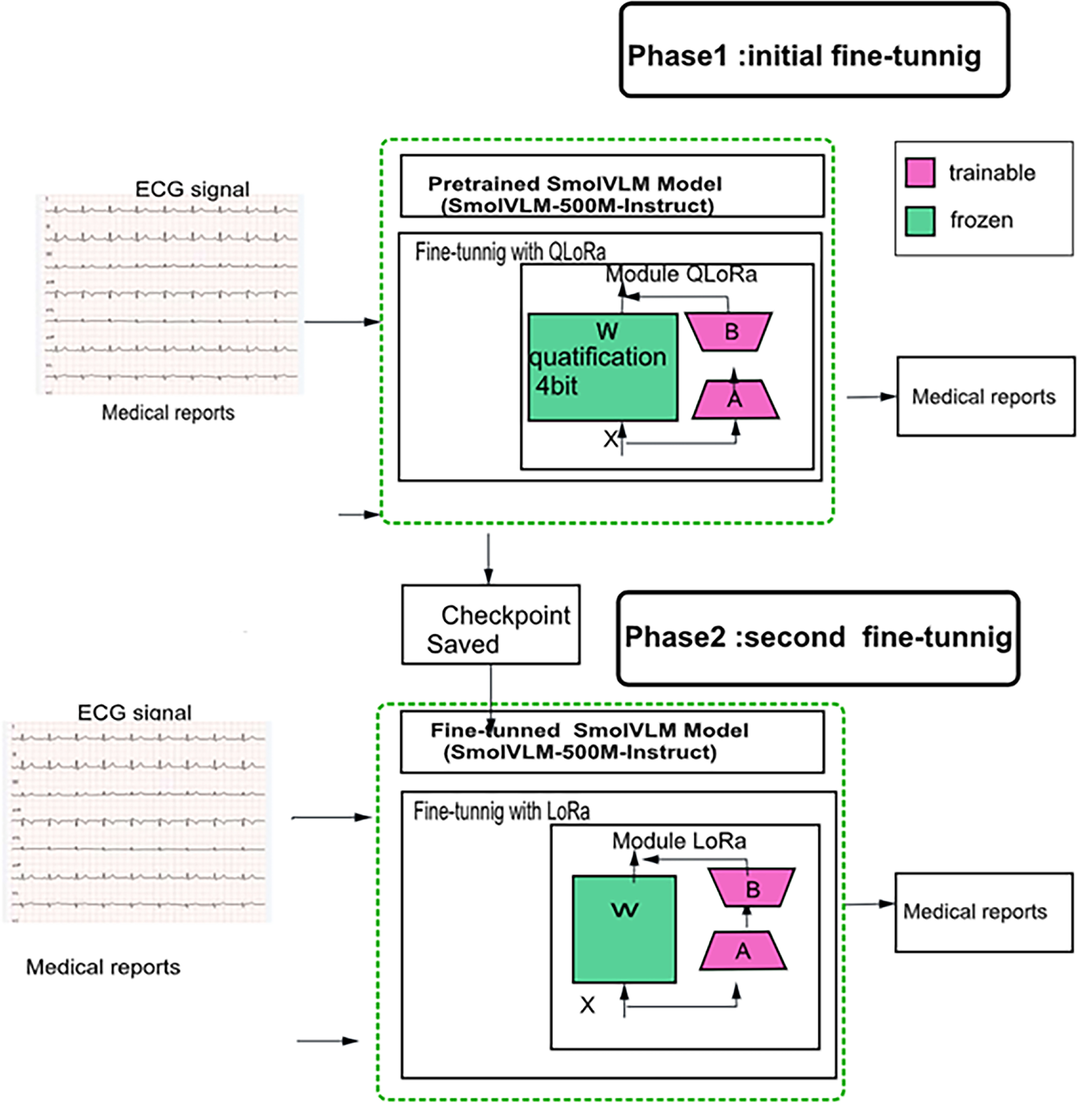 Two stage fine-tuned multimodal generative AI for automated ECG based ...