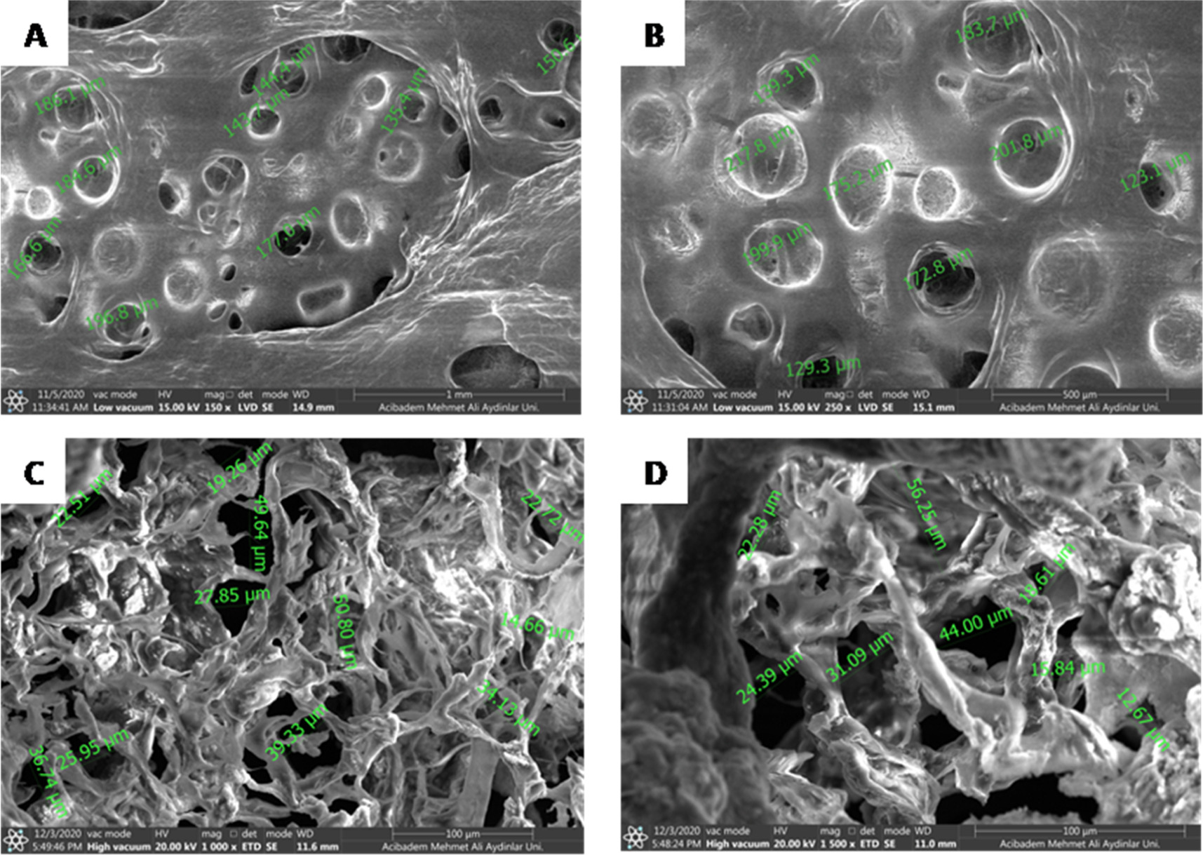 Encapsulation of human natural killer cells into novel gelatin-based ...