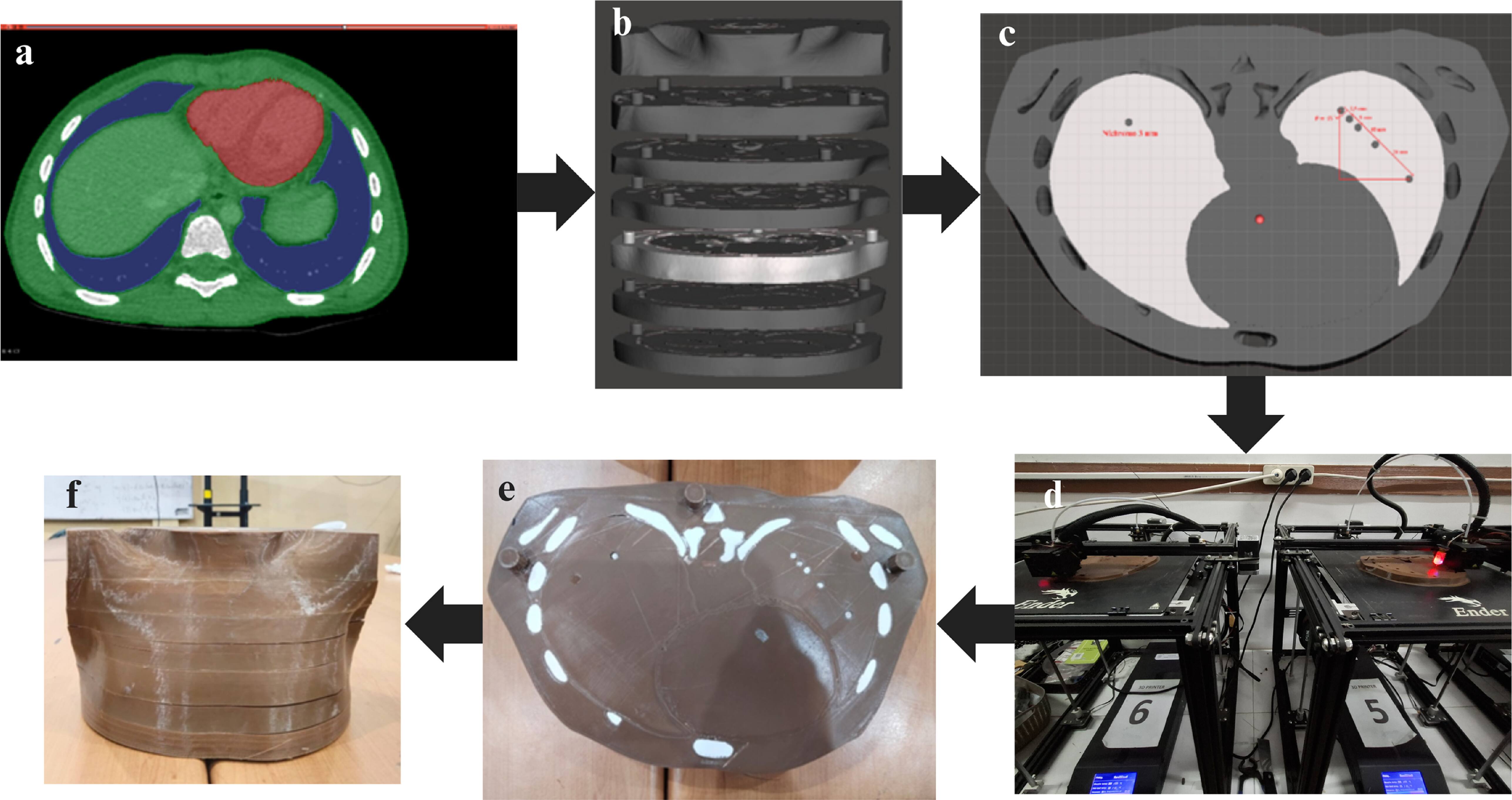 A comparative study of MTF methods for evaluating spatial resolution in ...