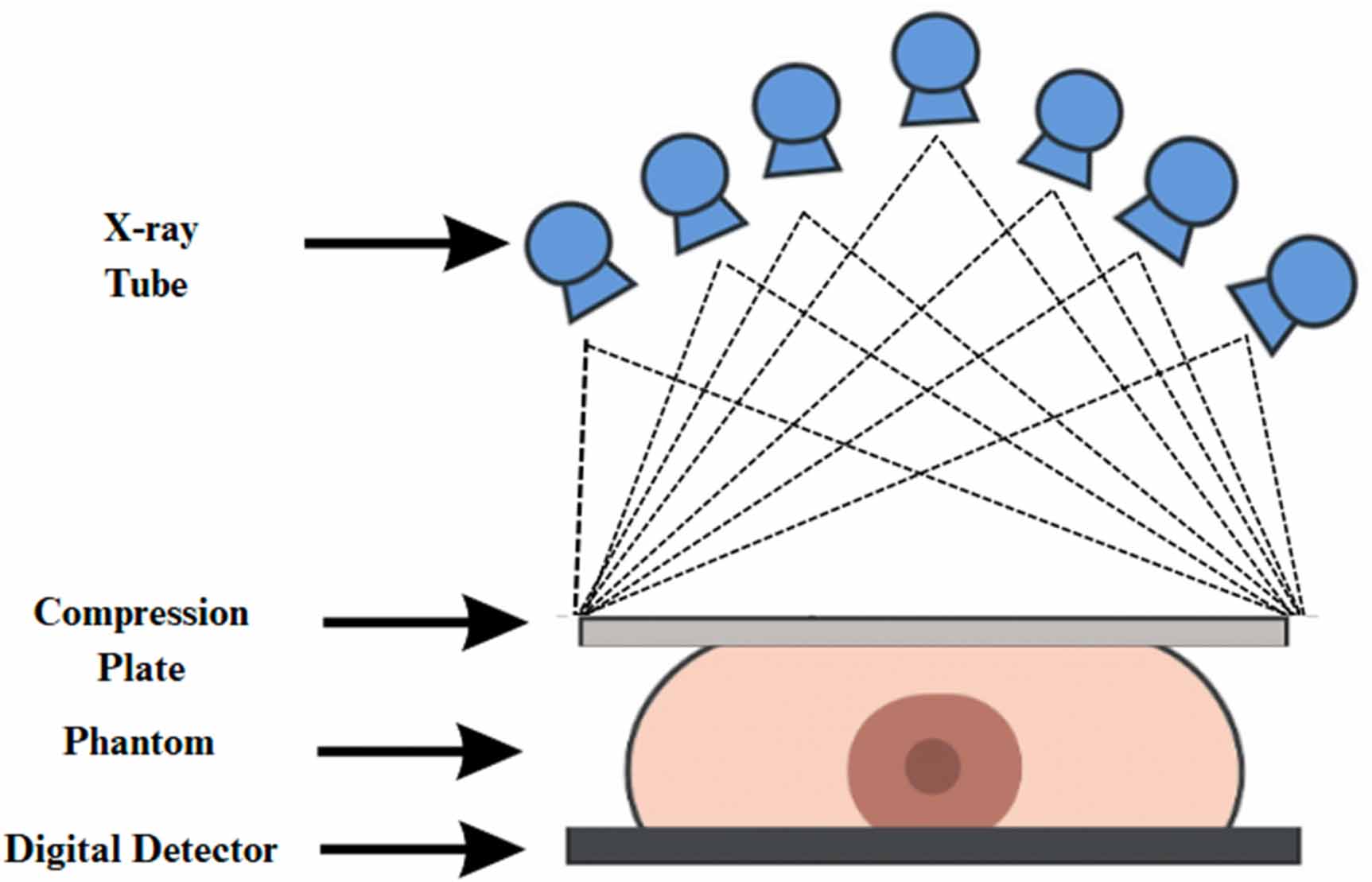 Evaluating the impact of reconstruction algorithms on digital breast ...
