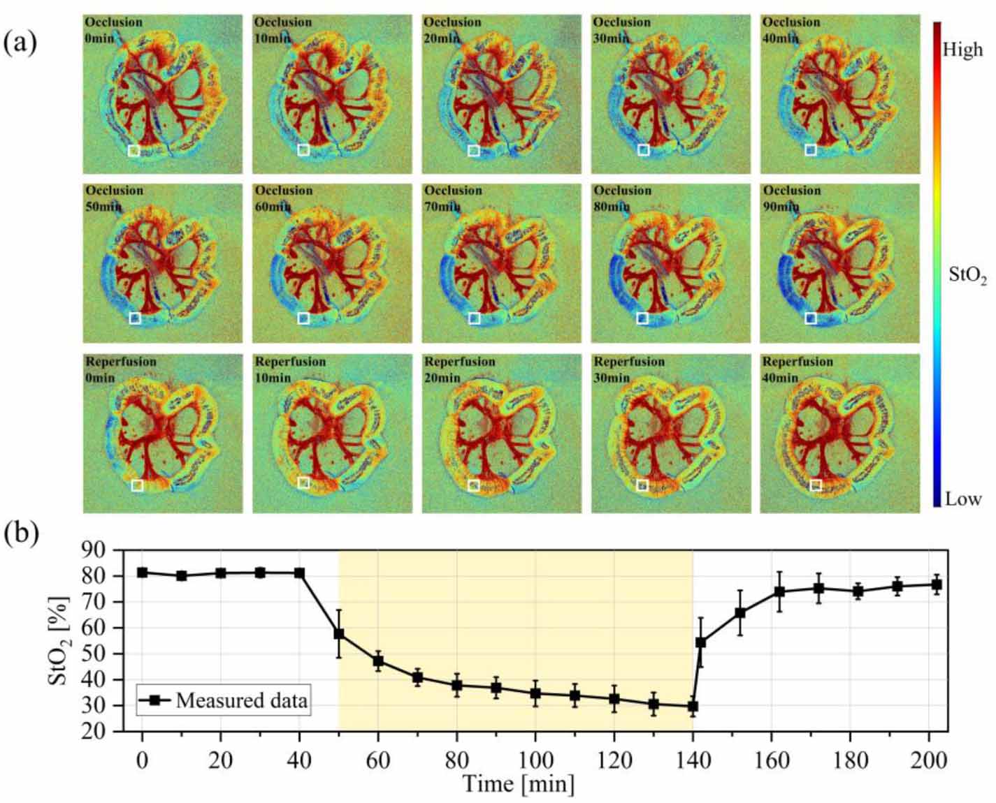Non-invasive dynamic blood oxygen monitoring system based on ...