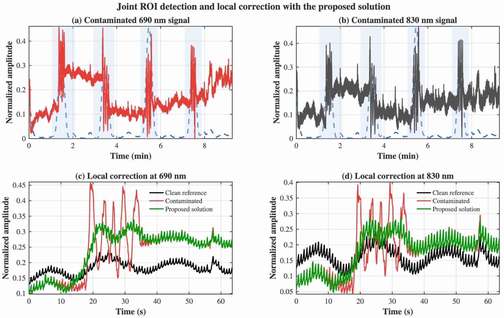 A dual stage wavelet workflow for motion artifact localization and ...