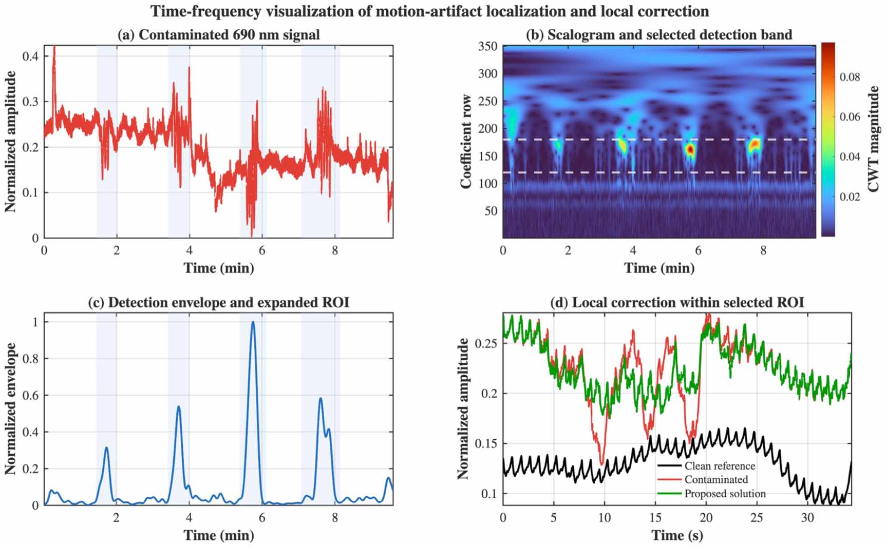 A dual stage wavelet workflow for motion artifact localization and ...