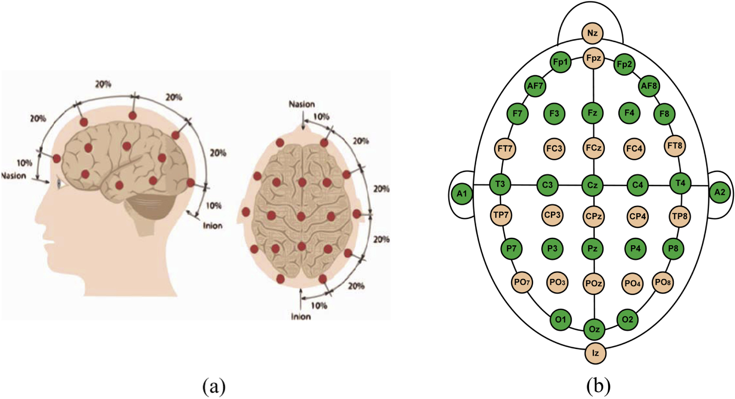 A robust motifs based artifacts removal technique from EEG - IOPscience