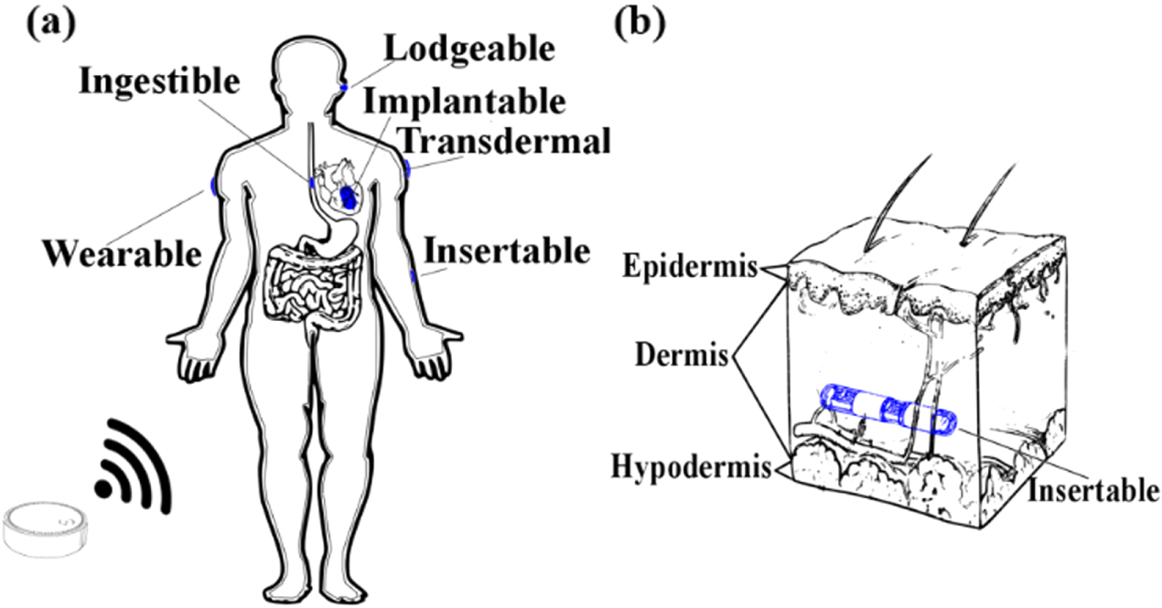 Beyond wearables and implantables: a scoping review of insertable ...
