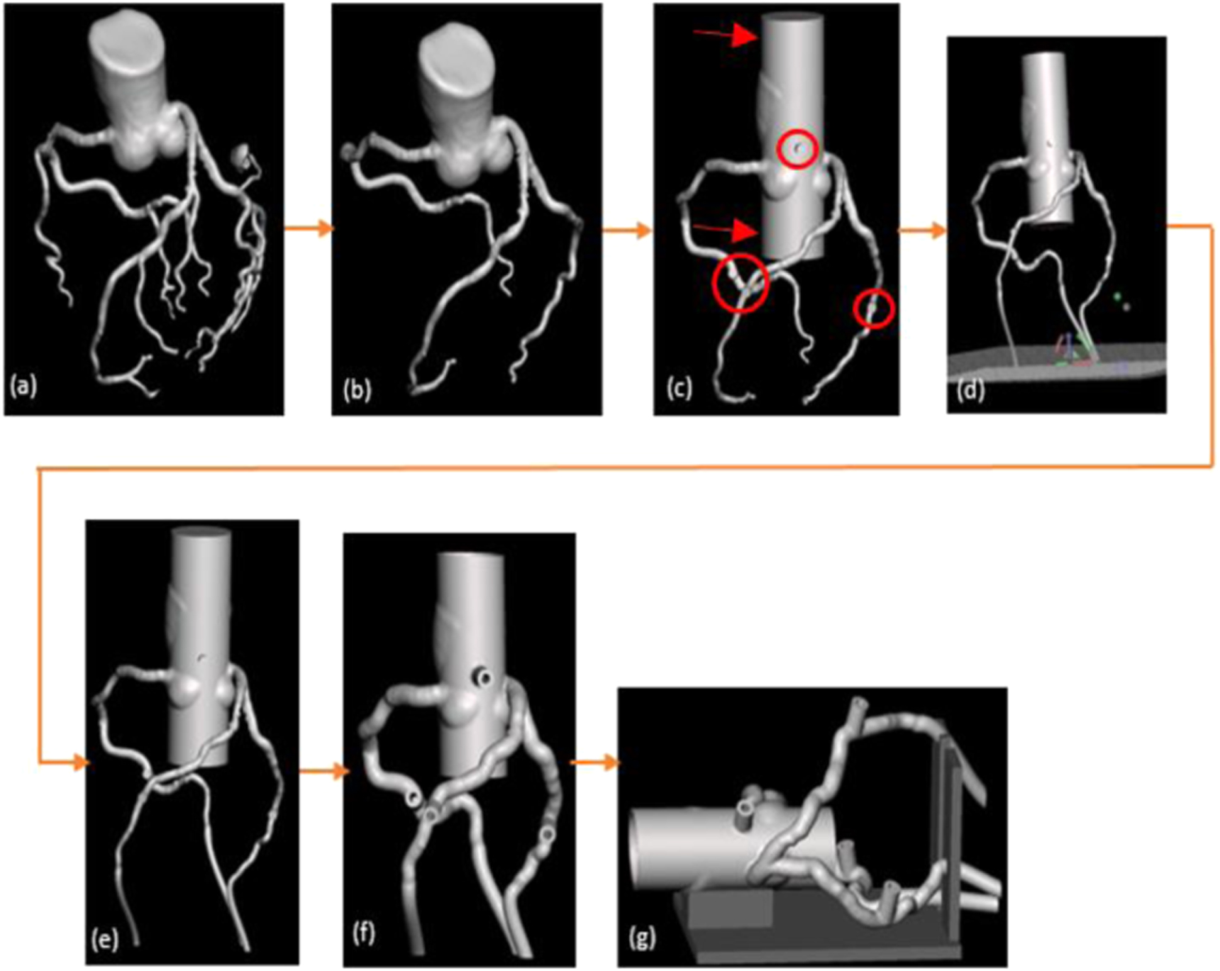 Patient-specific 3D-printed coronary models based on coronary computed ...