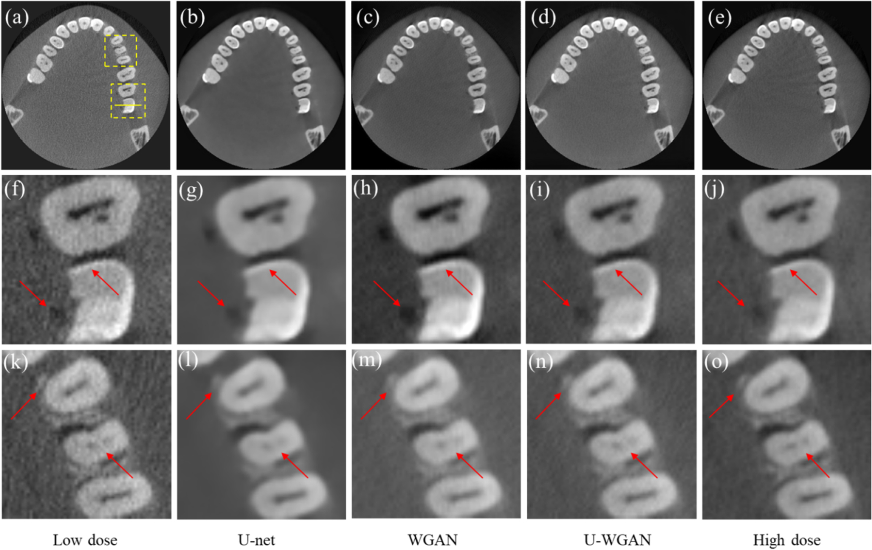 Image denoising by transfer learning of generative adversarial network ...