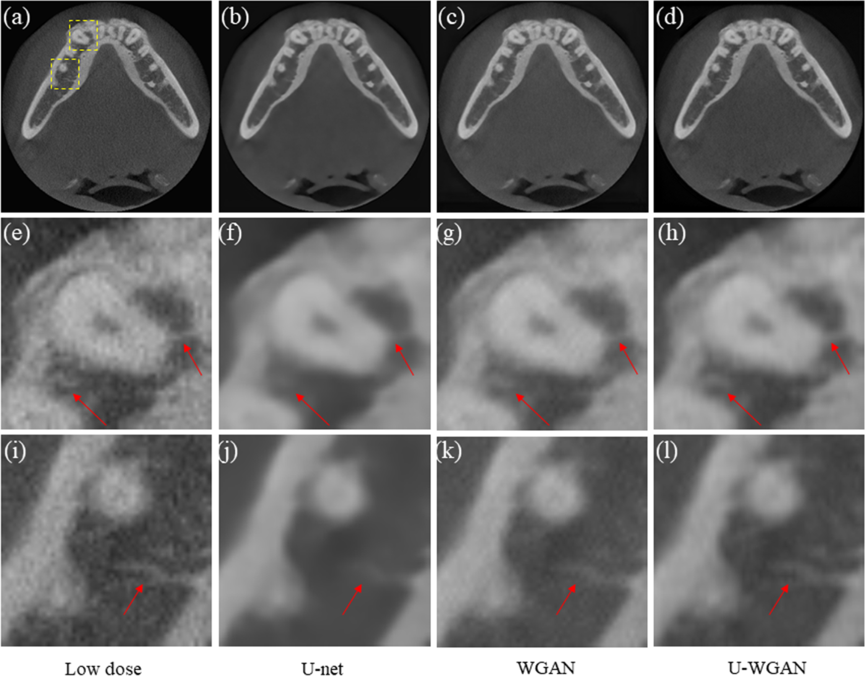 Image denoising by transfer learning of generative adversarial network ...