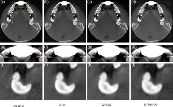 Image denoising by transfer learning of generative adversarial network ...