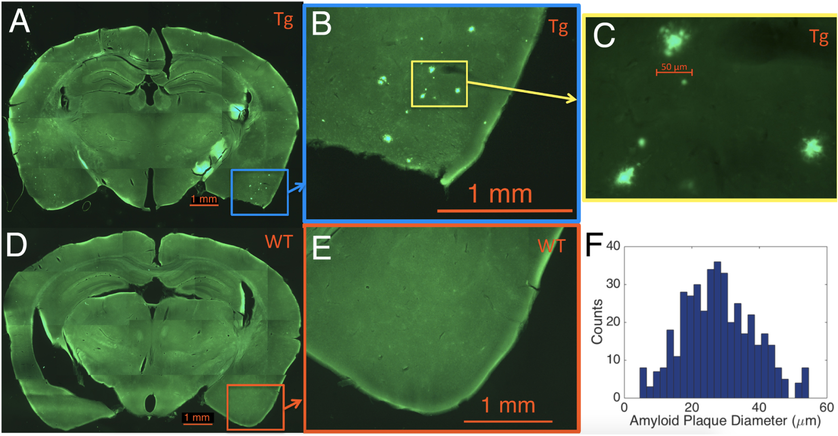Feasibility of imaging amyloid in the brain using small-angle x-ray ...