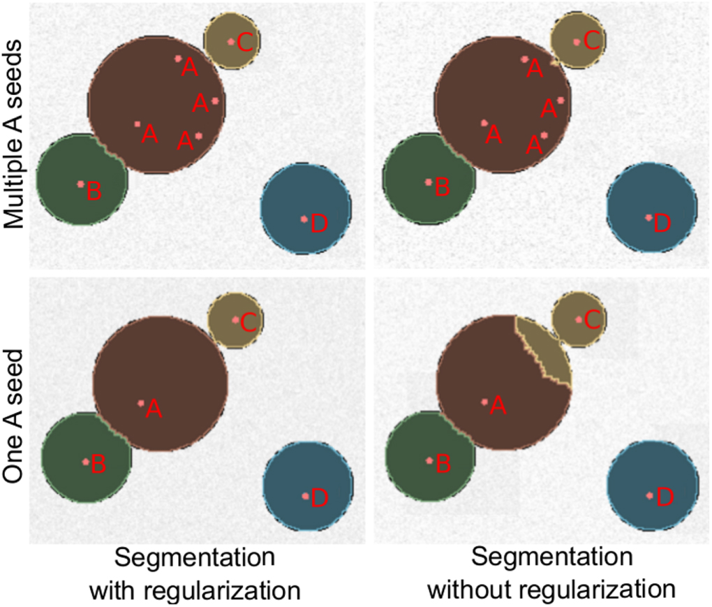 Semi-automatic segmentation of whole-body images in longitudinal ...