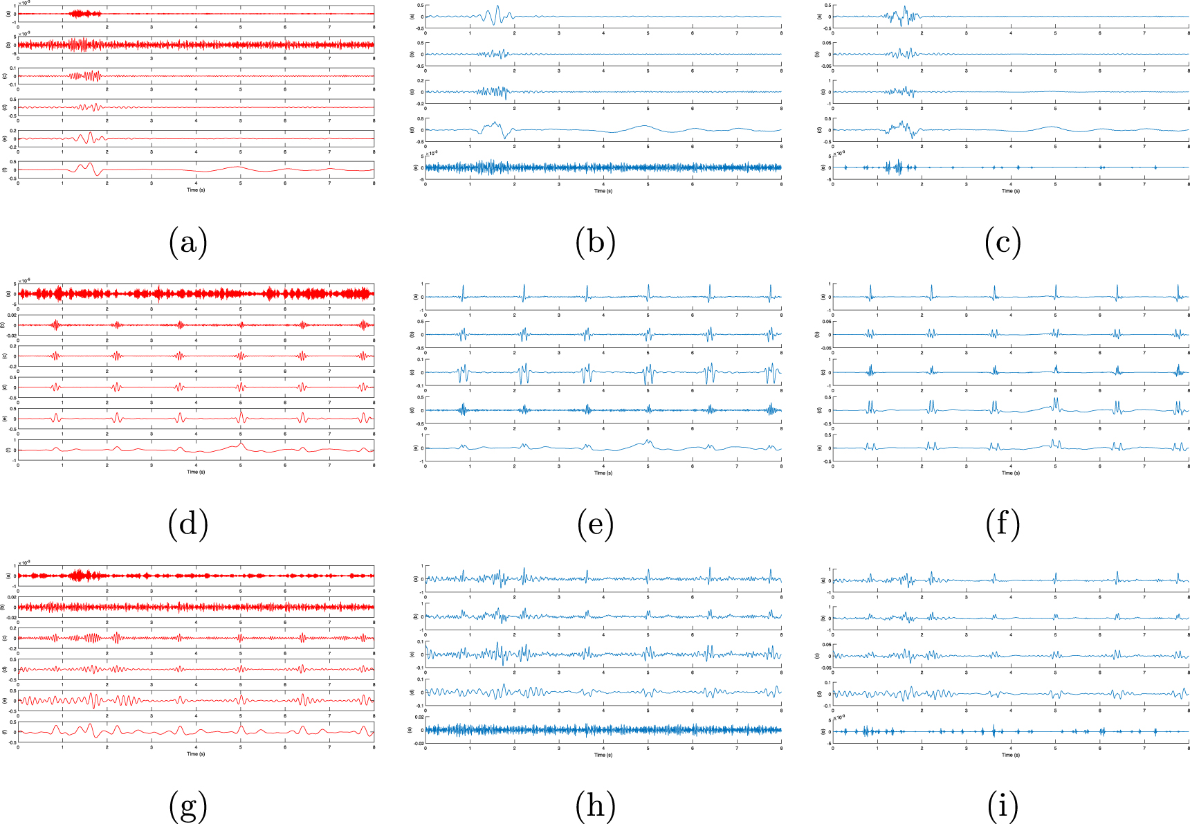 Hybrid algorithm for multi artifact removal from single channel EEG ...